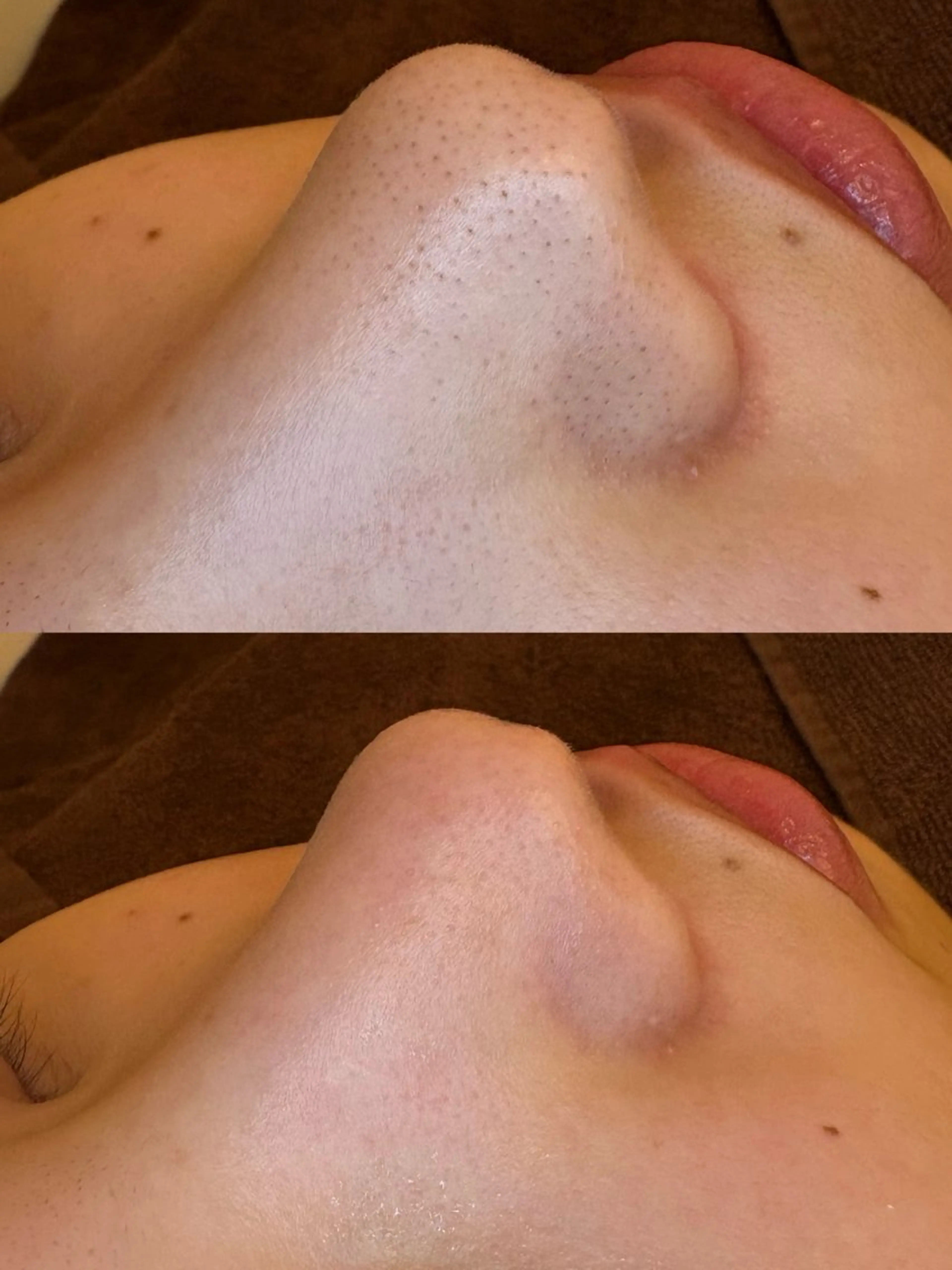 🤍アベシュリ /フェイシャル🤍のエステ・リラクイメージ