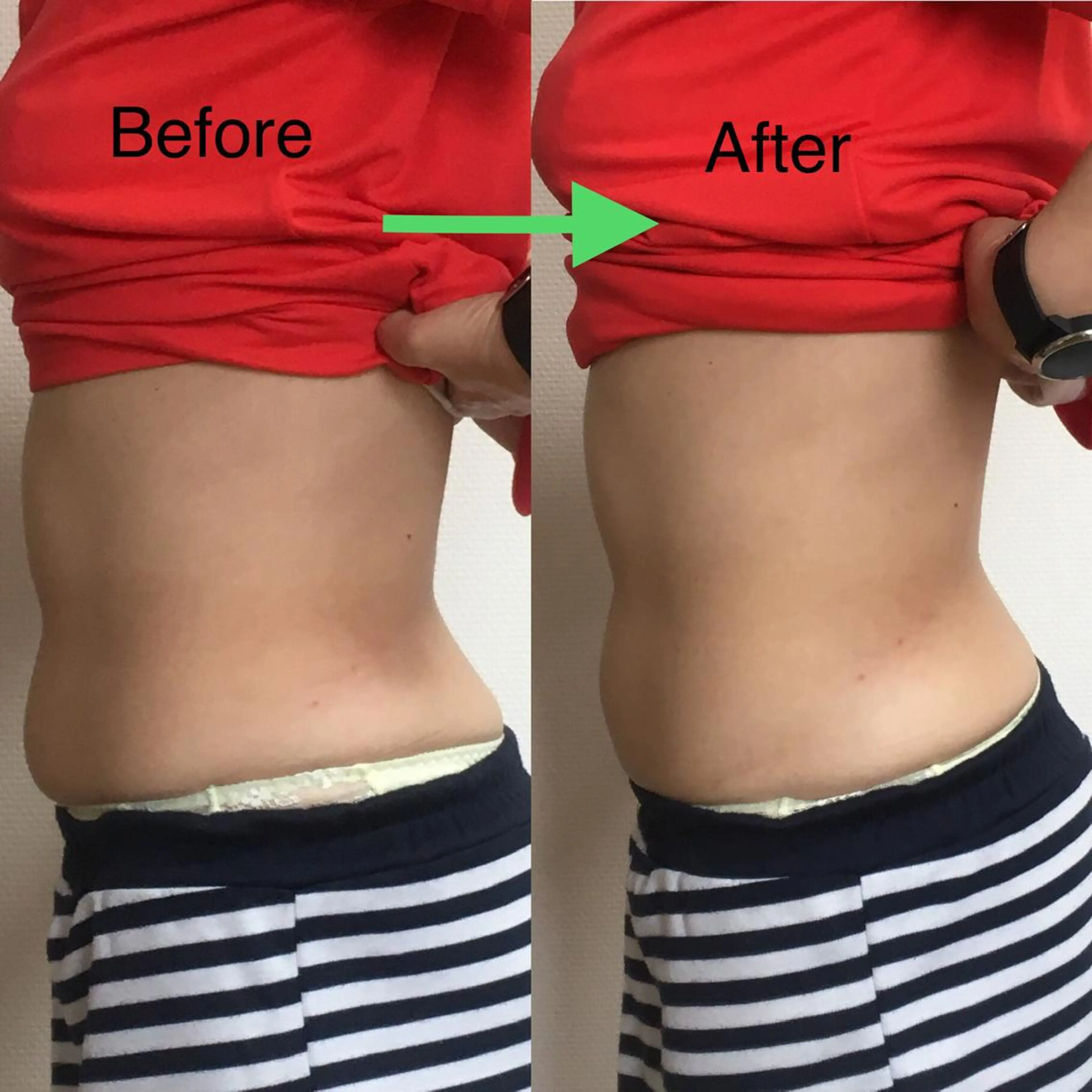 エステ Bell Tree すずきのエステ・リラクイメージ