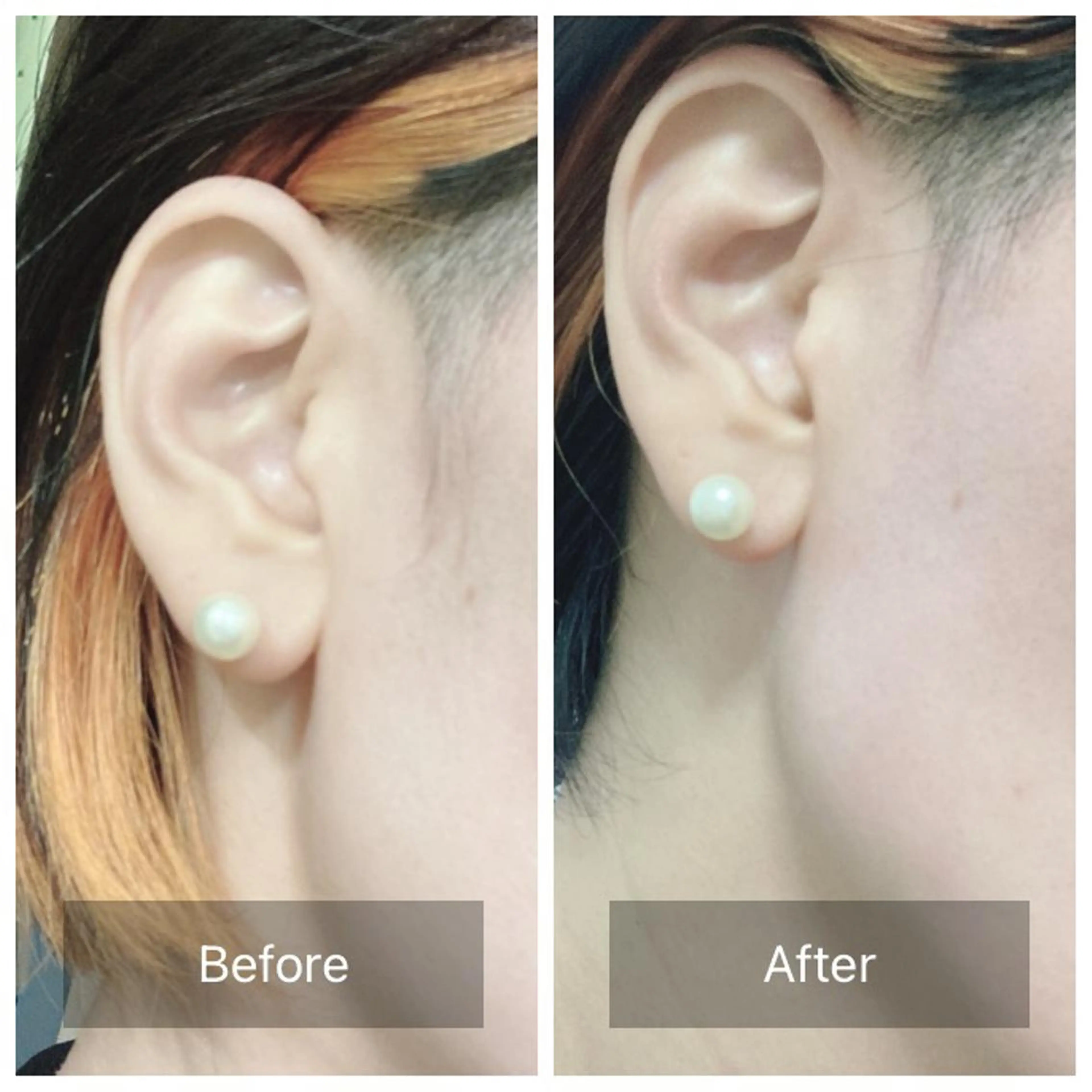 脱毛 産毛専門店 Bittoのエステ・リラクイメージ