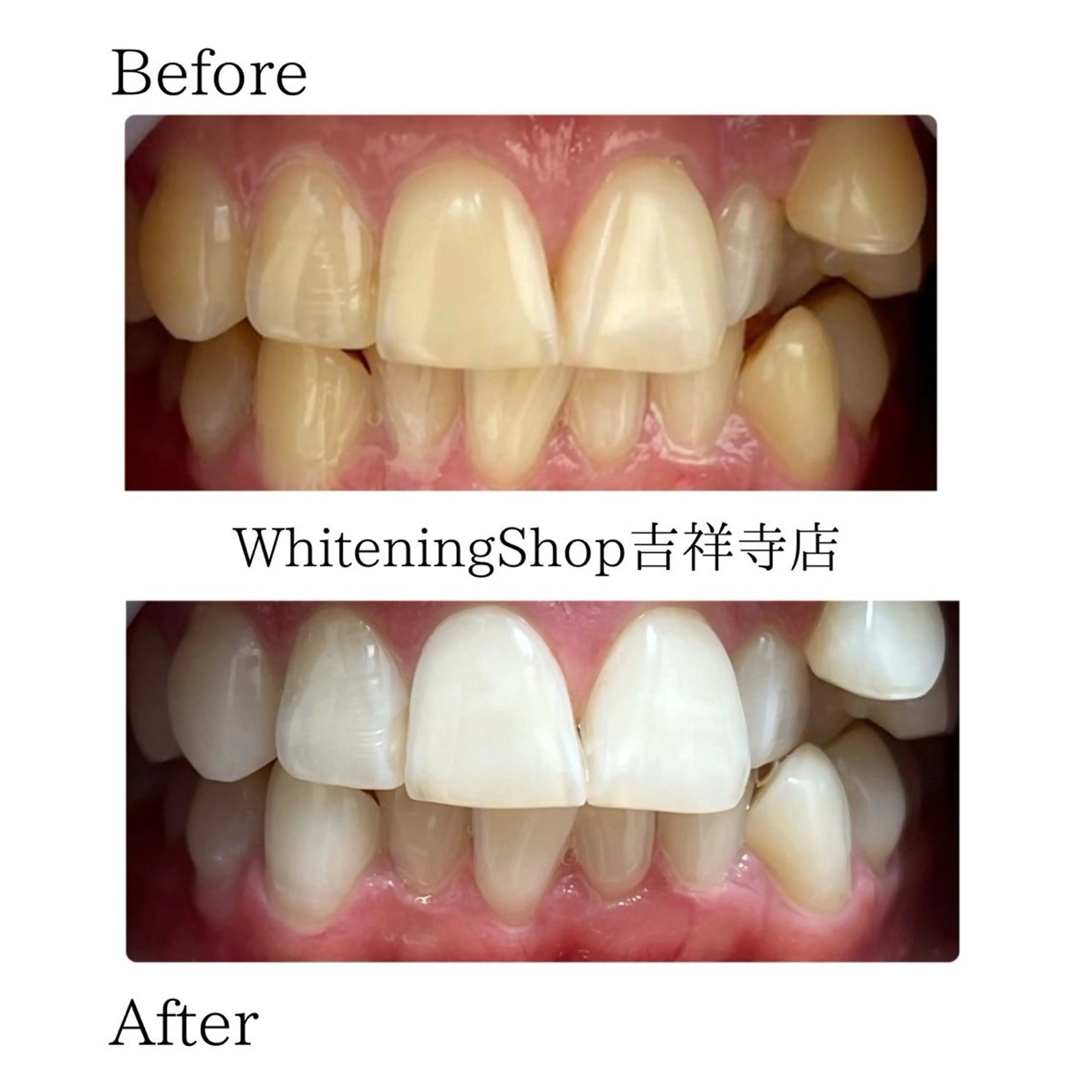 エステ リラク ホワイトニング ショップ吉祥寺店のエステ・リラクイメージ