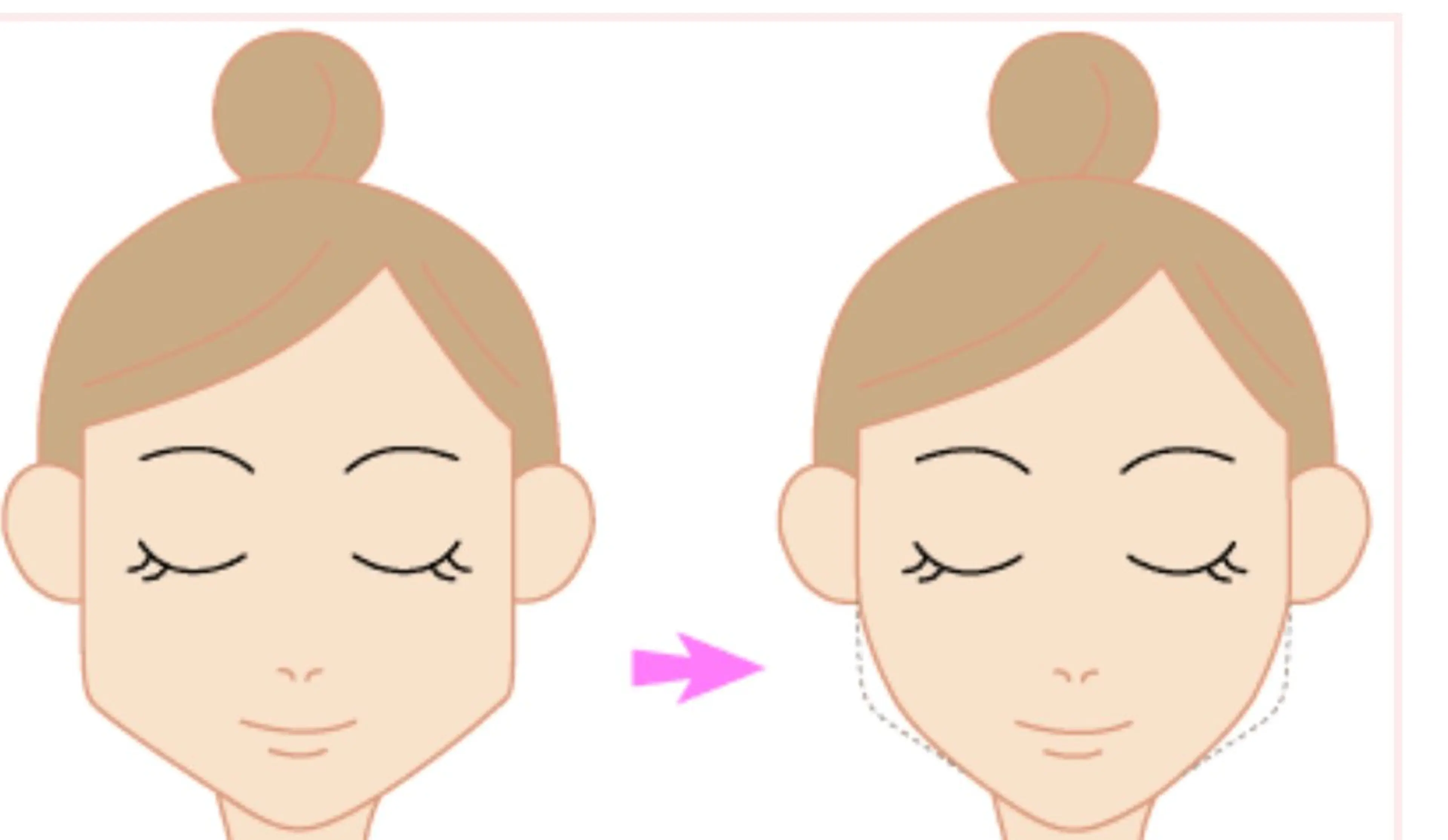 エステ リラク ☺ハーブピール💕 ソフィアカロン💖のエステ・リラクイメージ