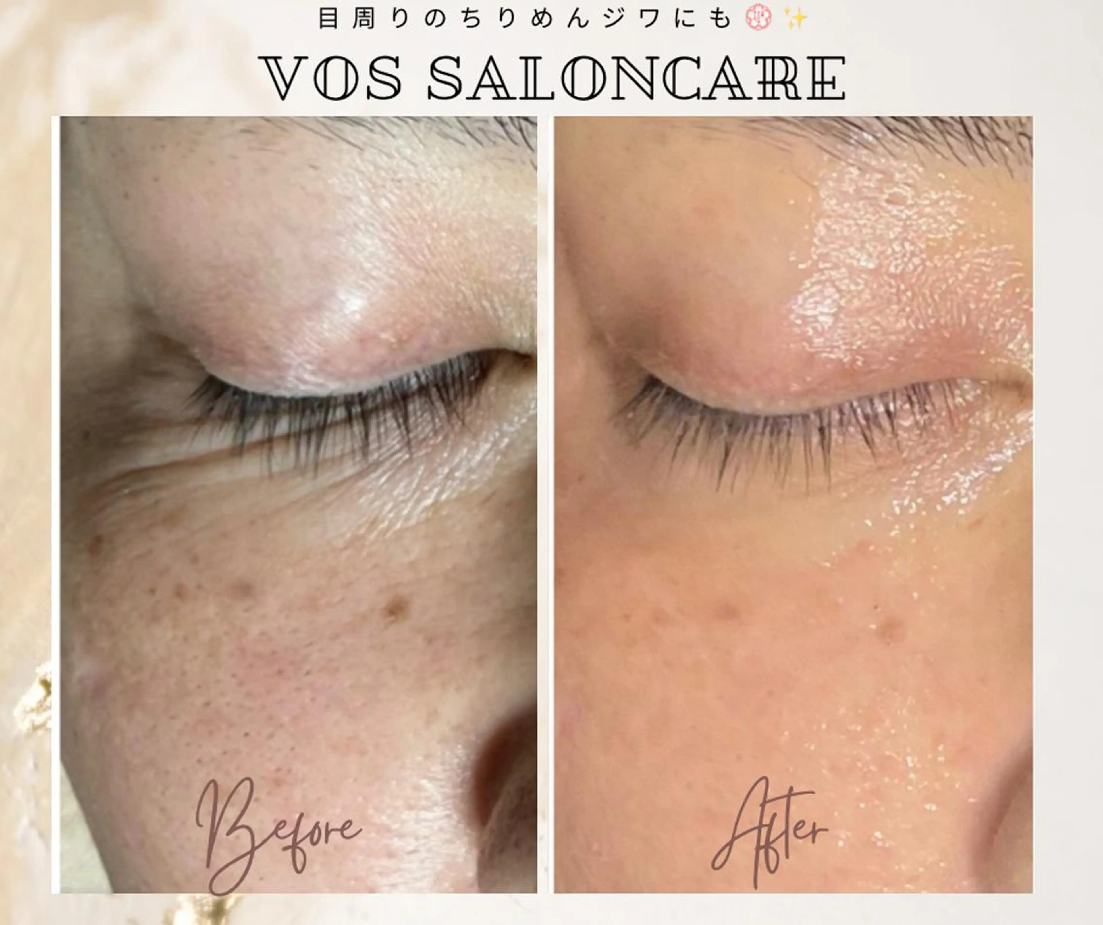 ロング カラー パーマ ヘアアレンジ メンズ キッズ ネイル マツエク・マツパ アイブロウ 代表 MOMOのエステ・リラクイメージ