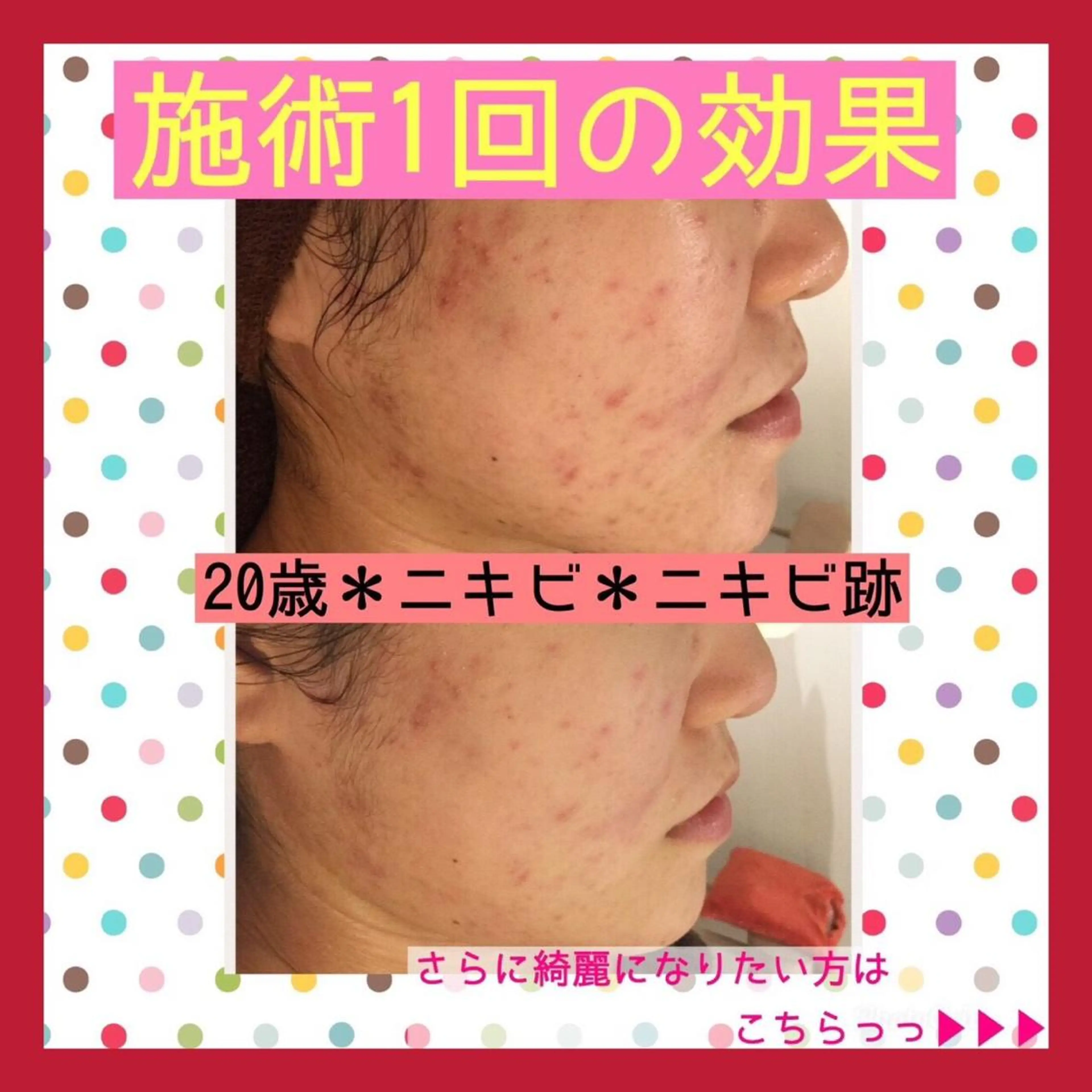 ミディアム カラー パーマ ヘアアレンジ メンズ キッズ ネイル マツエク・マツパ ニキビ・肌質改善専門 ♡人生が変わるサロンのエステ・リラクイメージ