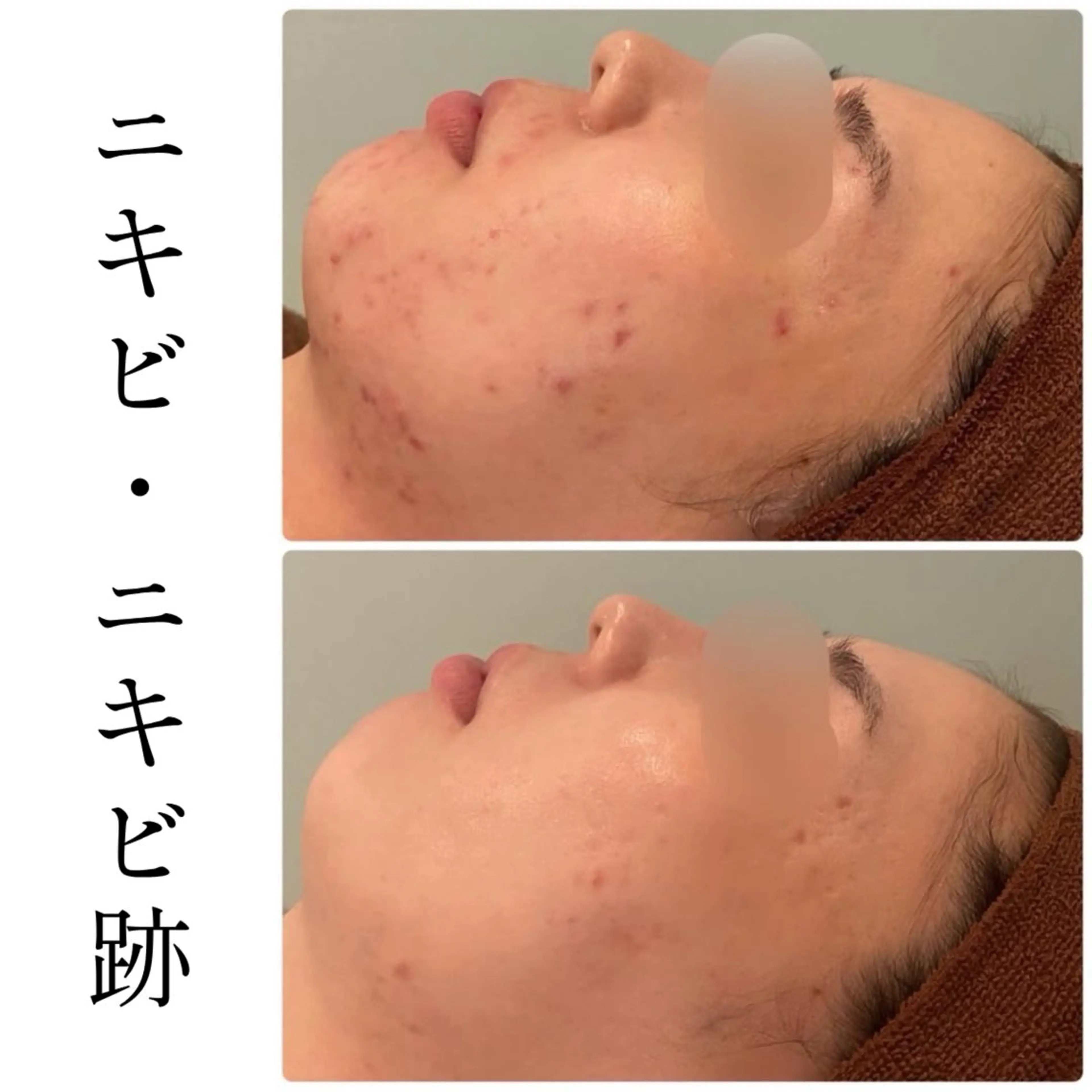 エステ ハーブピーリング専門 BIOEL横浜のエステ・リラクイメージ