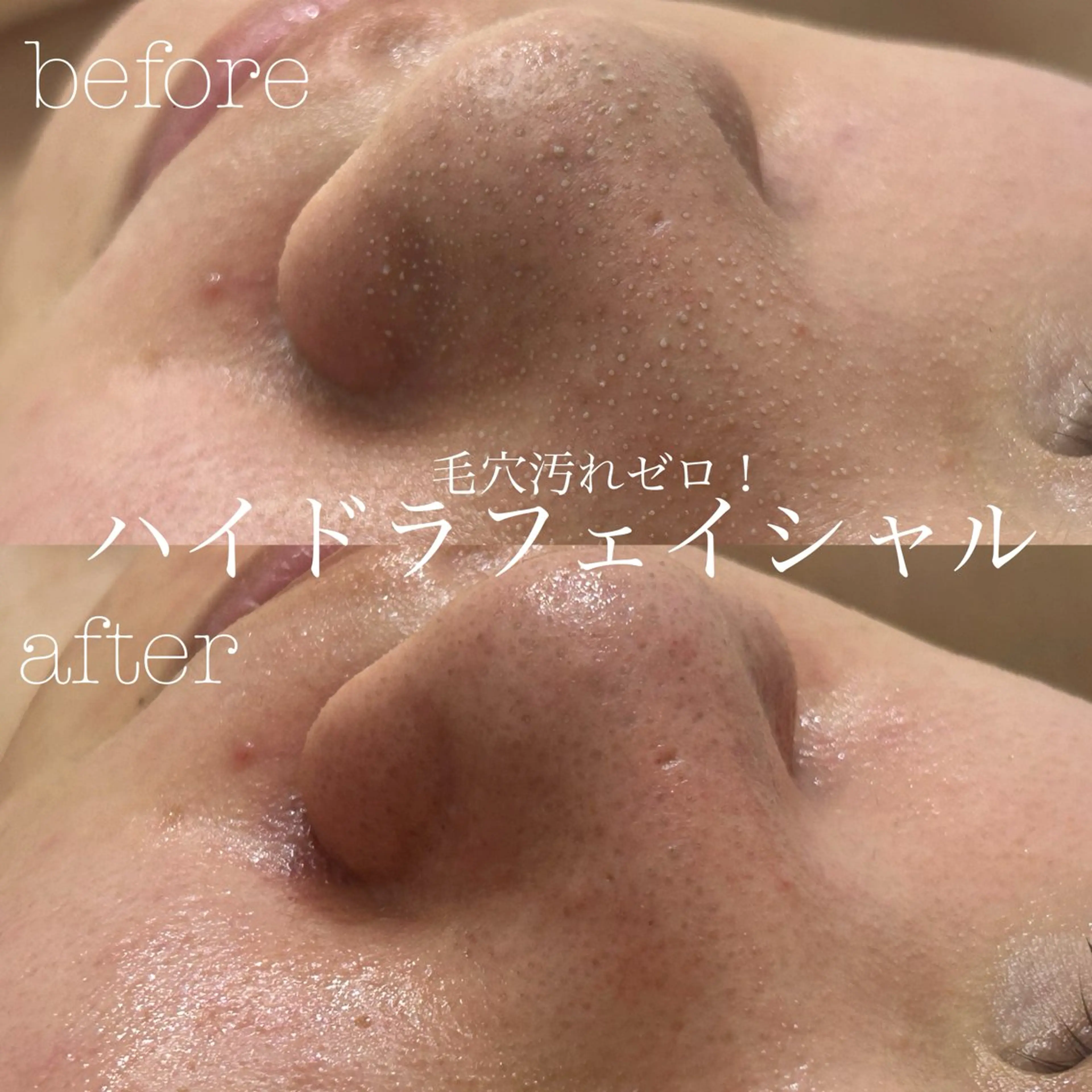 エステ フェイシャルサロン CHIARA 荒田のエステ・リラクイメージ