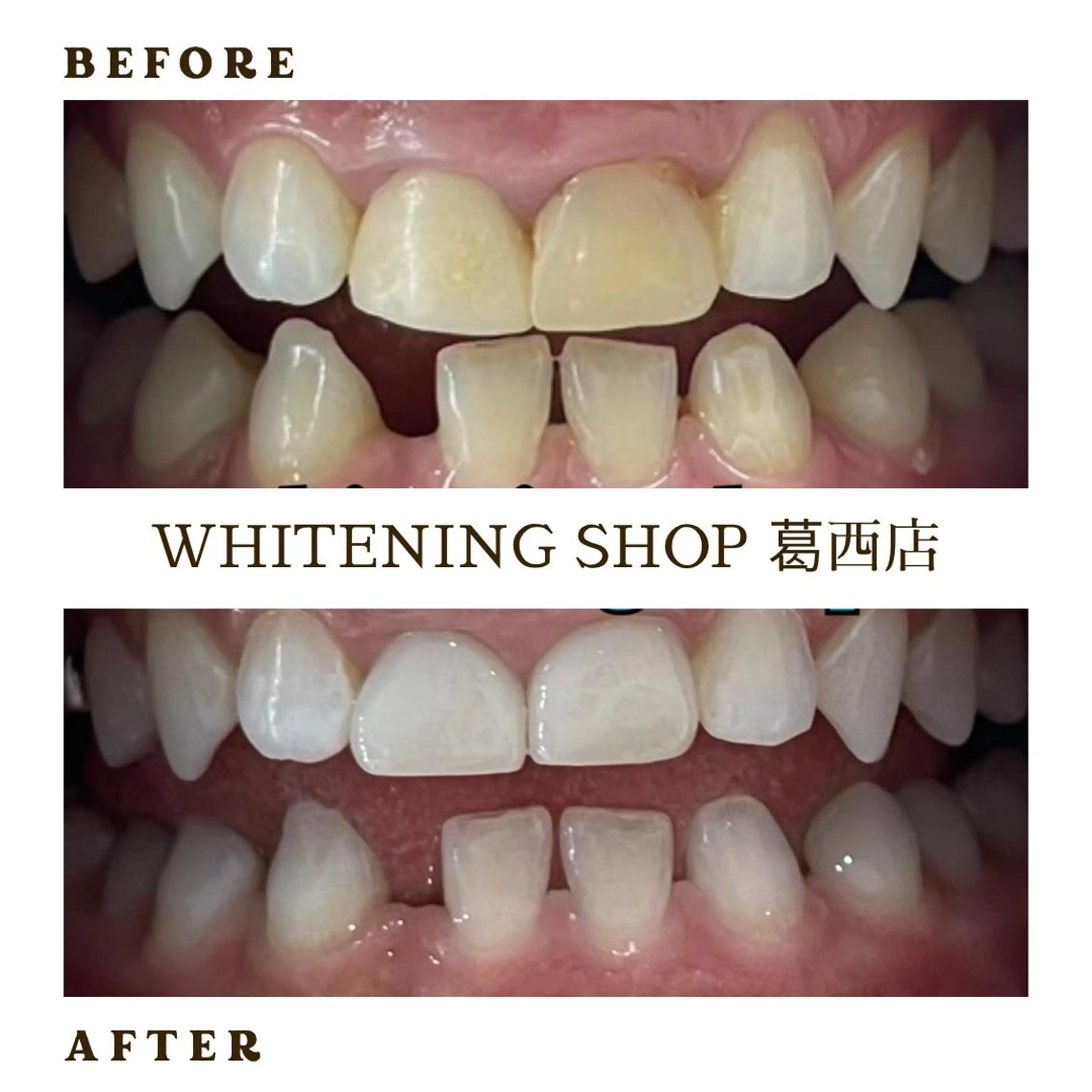 メンズ その他 ホワイトニング ショップ葛西店のその他イメージ