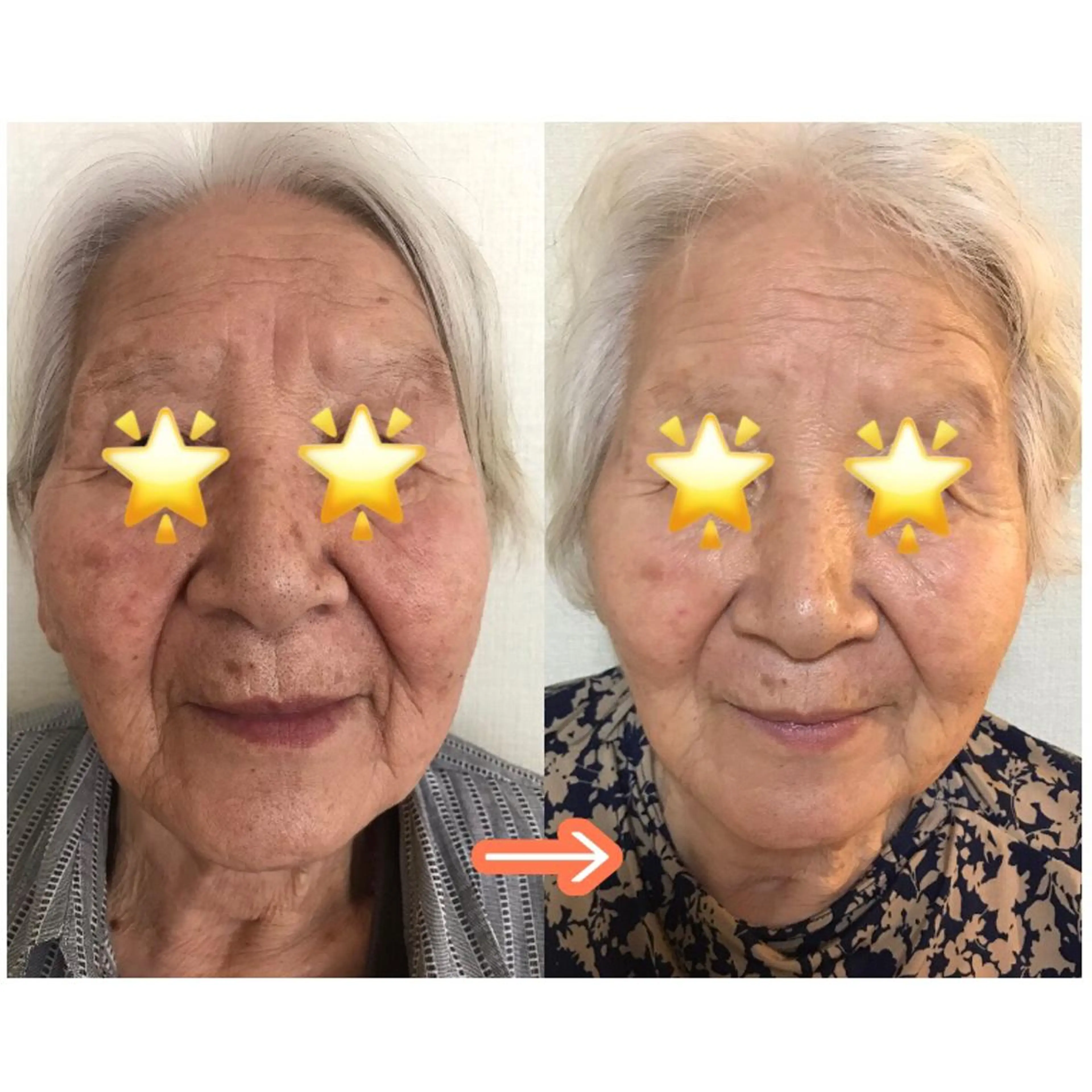 ゆか/エステサロン Lilasmileのエステ・リラクイメージ