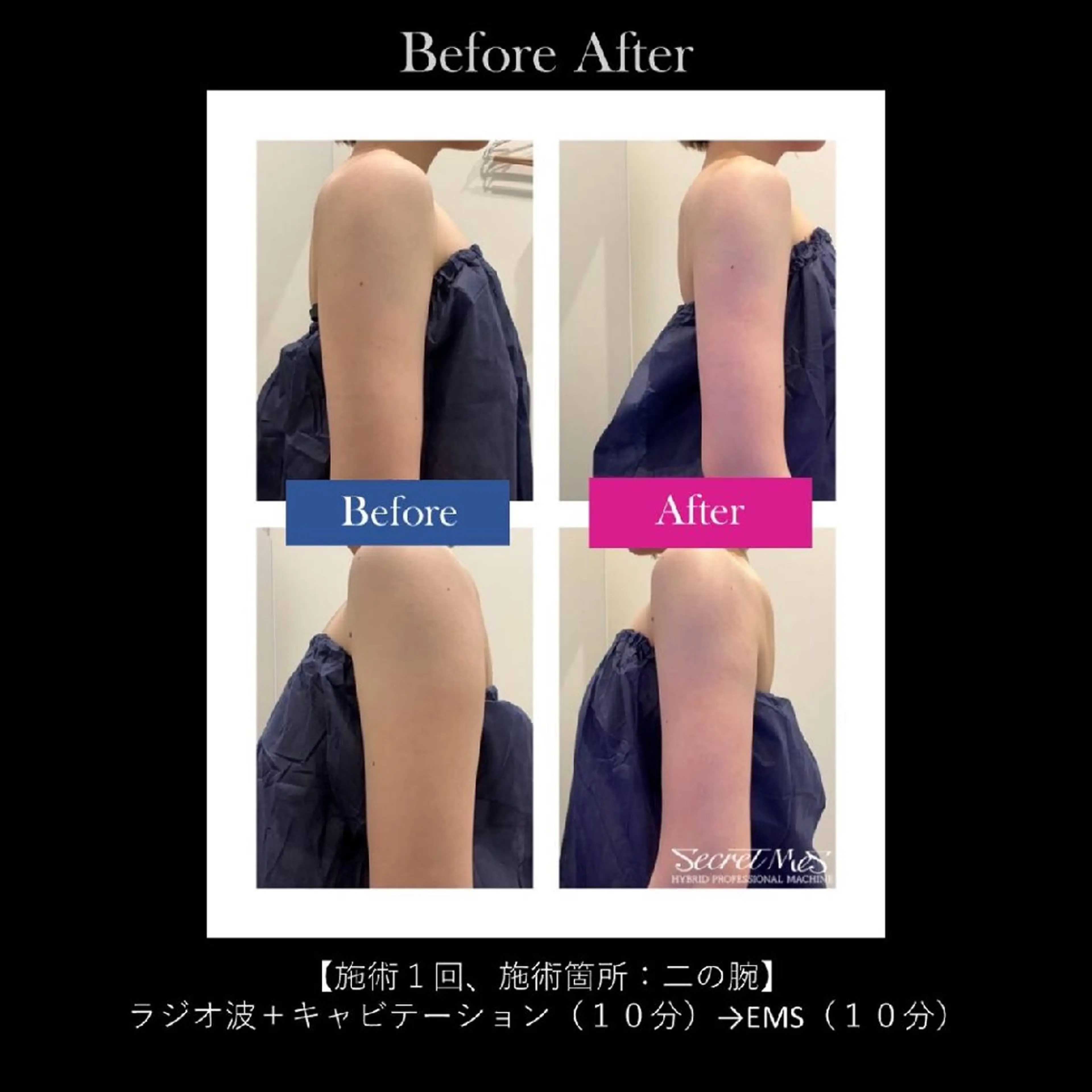 エステ エステ Roomのエステ・リラクイメージ