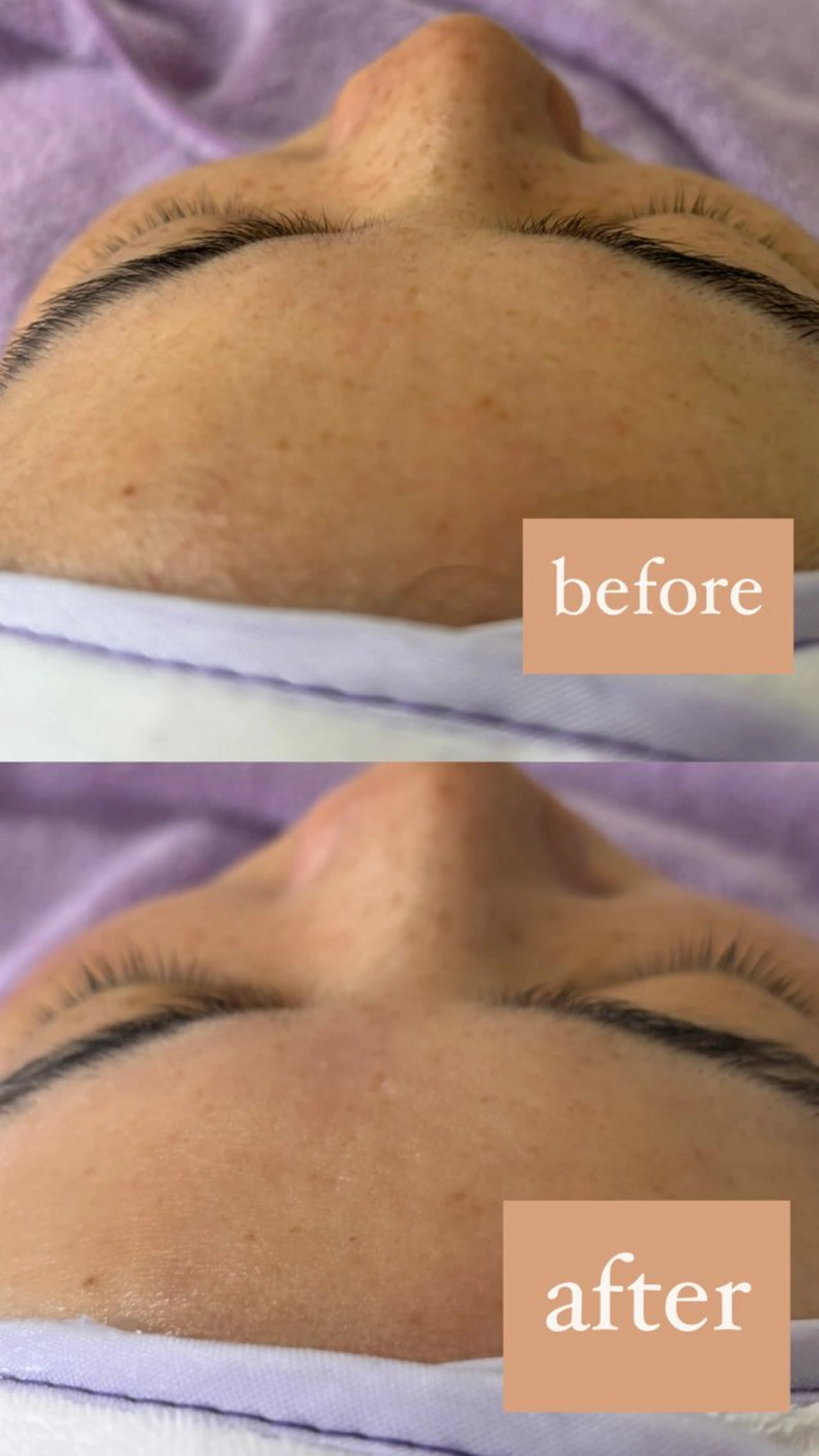 脱毛 木村 千広のその他イメージ