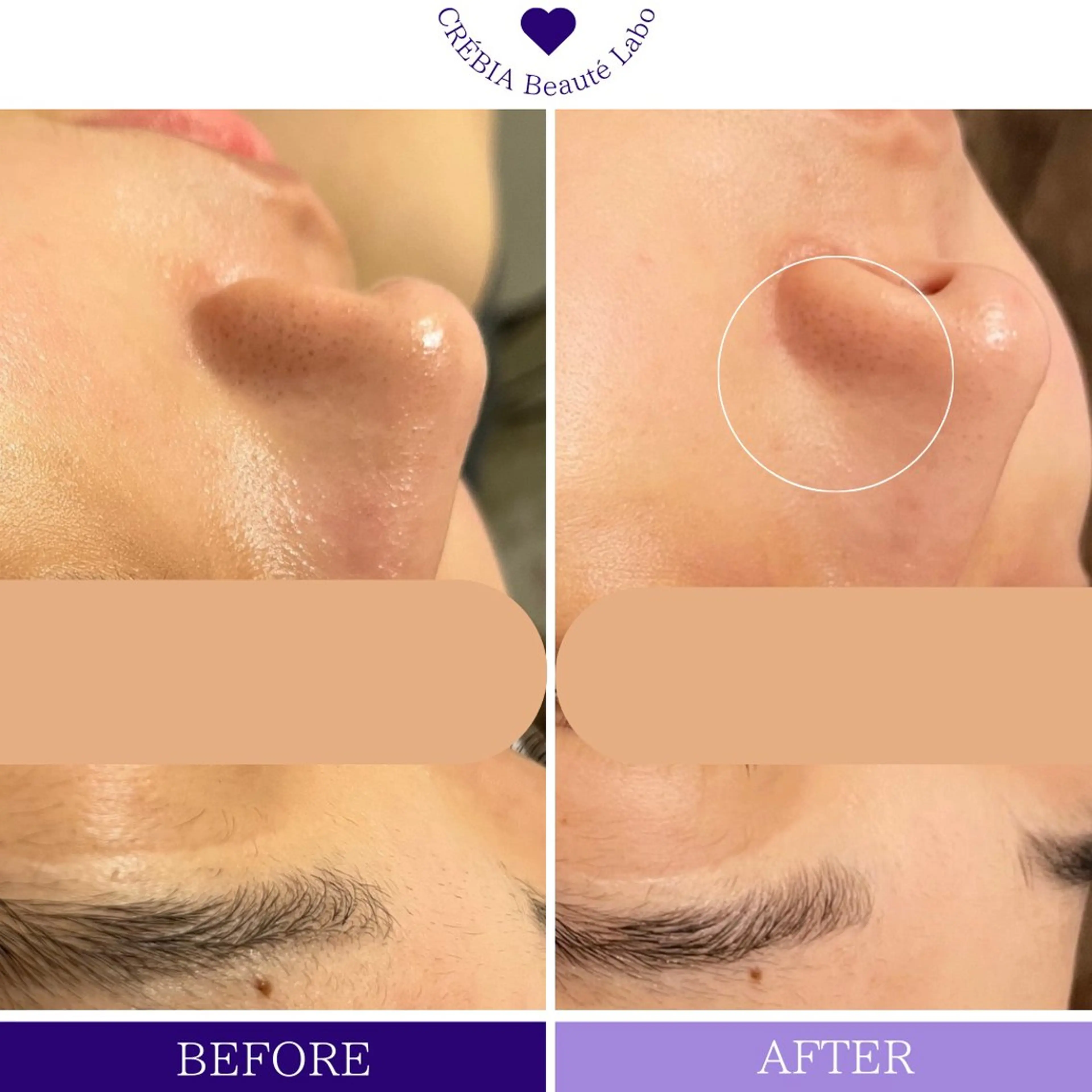 エステ 小顔＆まつ毛サロン AKANE❤️のエステ・リラクイメージ