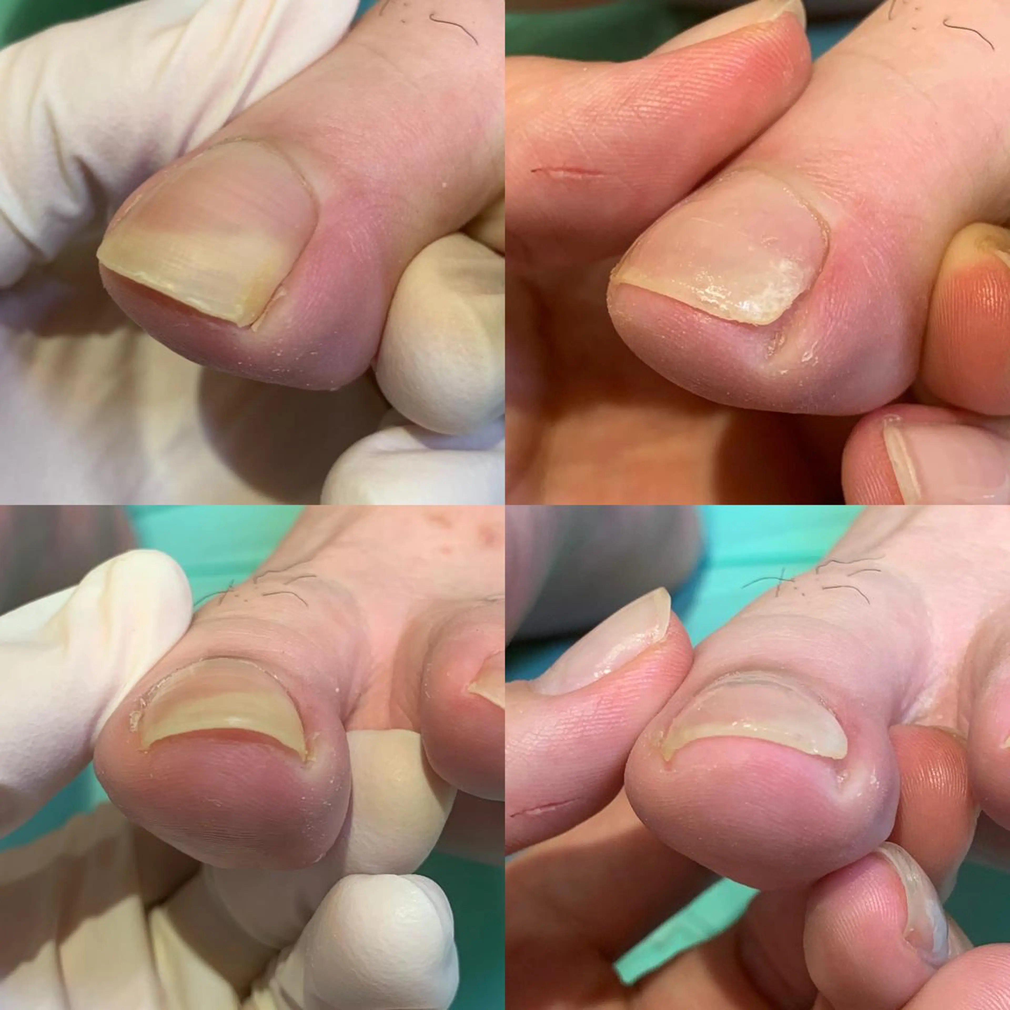 ネイル 東京巻き爪アカデミー所属・東京巻き爪 アカデミーのエステ・リラクイメージ