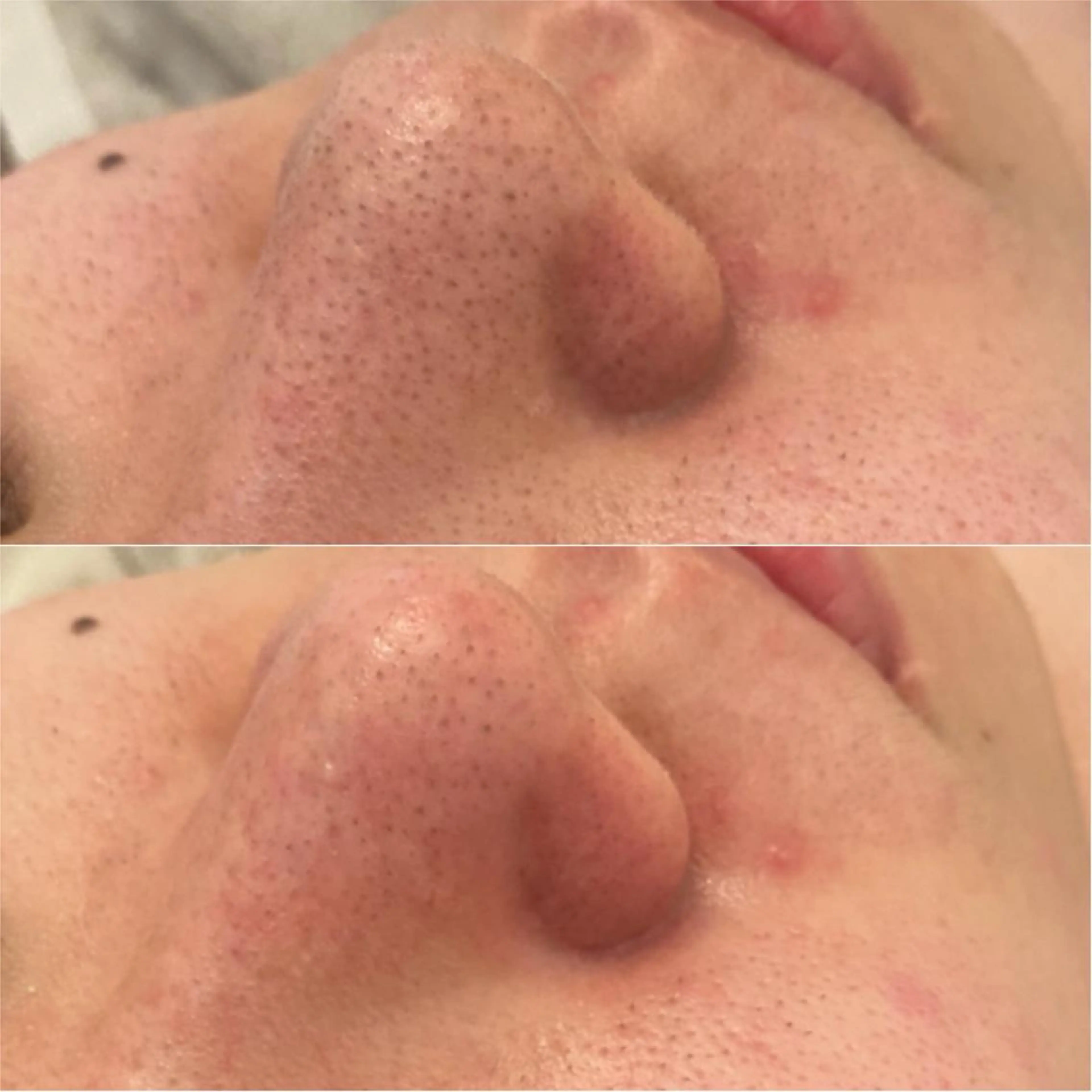 ララ/ハーブ メゾンリュバンのエステ・リラクイメージ