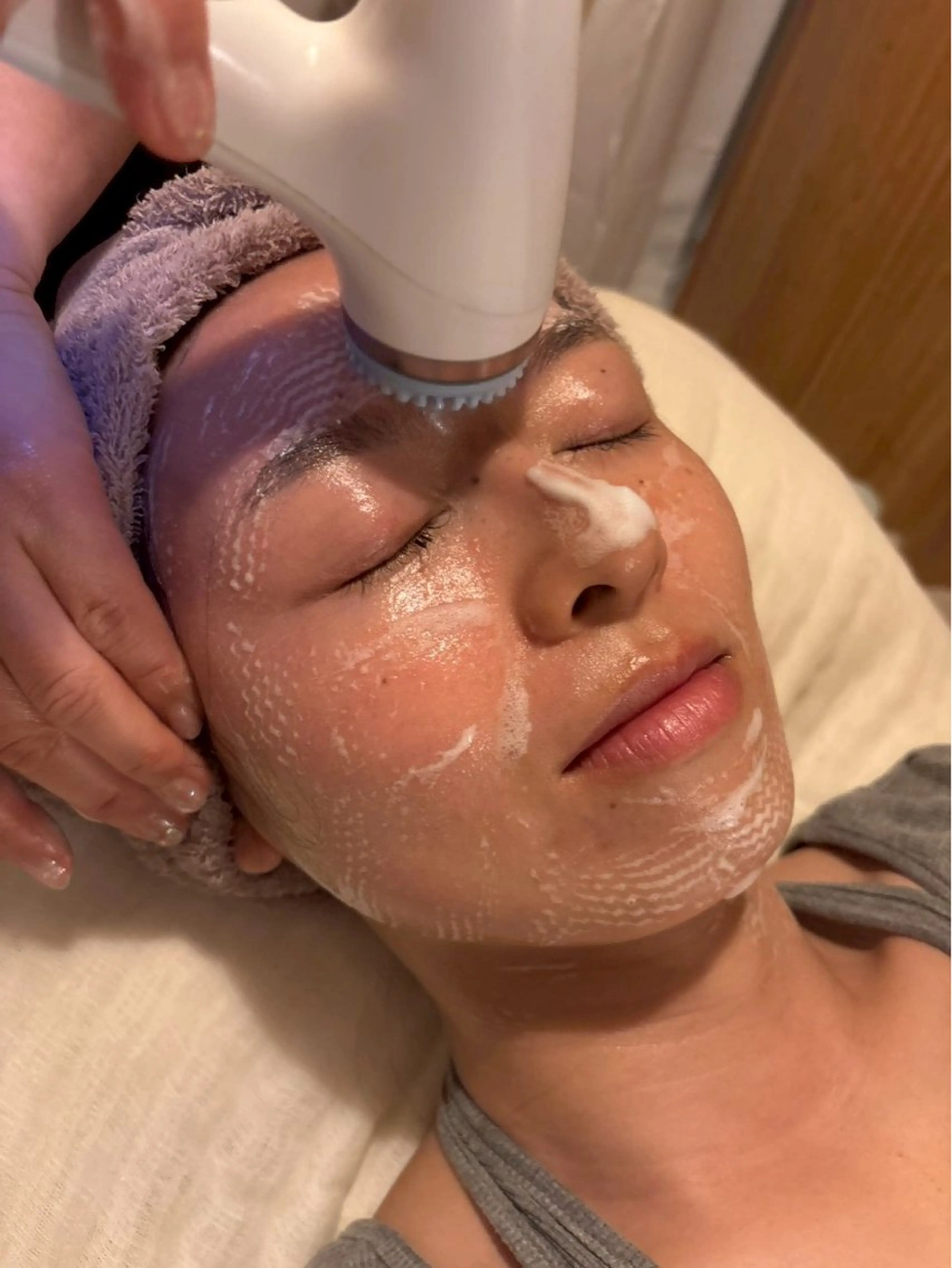 【人気Ｎｏ．1毛穴フェイシャル】たるみ毛穴、小顔、ほうれい線、乾燥肌などエイジングサインに◎の写真