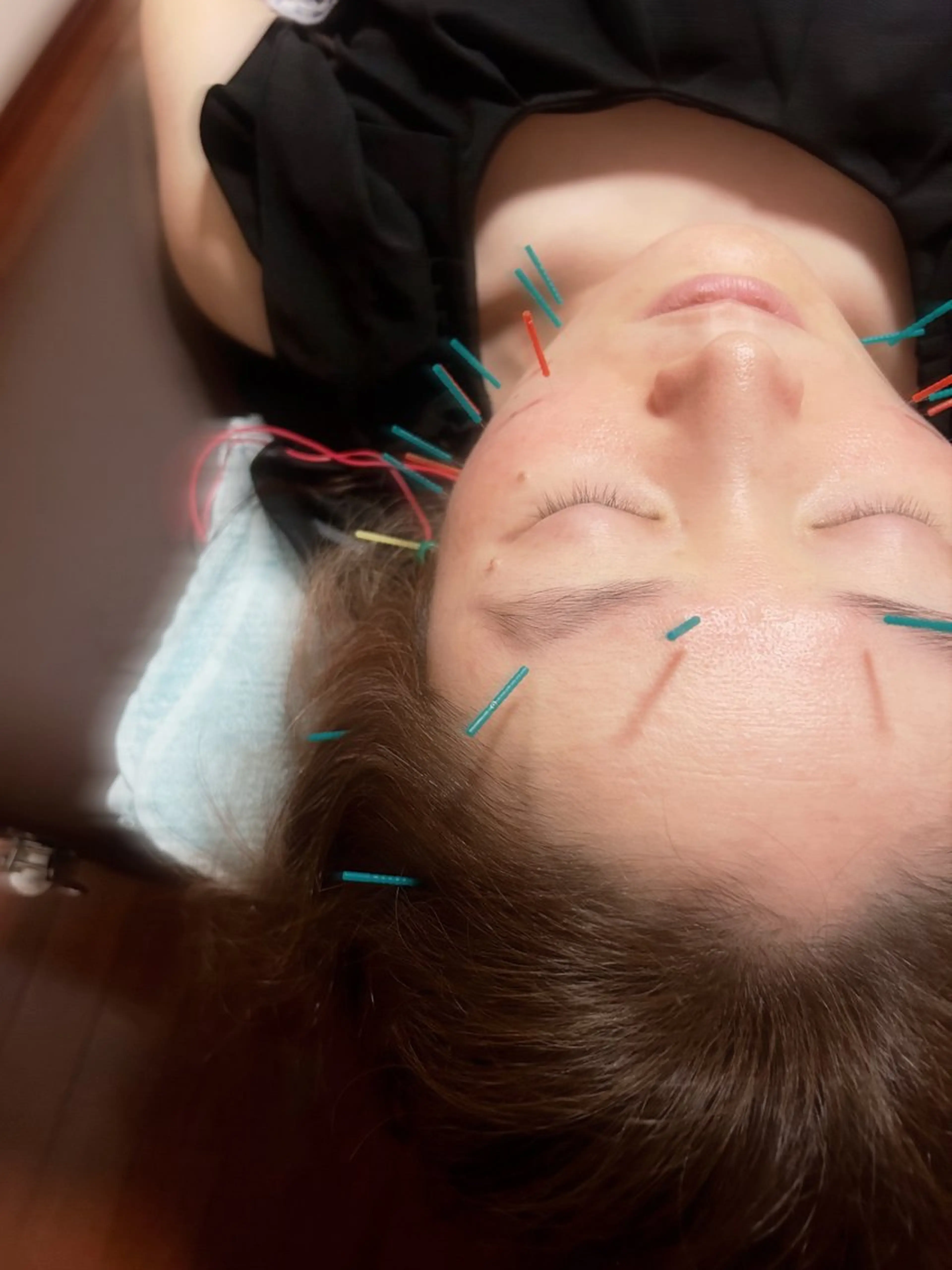 代々木美容鍼灸サロン"さくら"所属・🌸代々木美容鍼灸 サロン"さくら"🌸のエステ・リラクイメージ