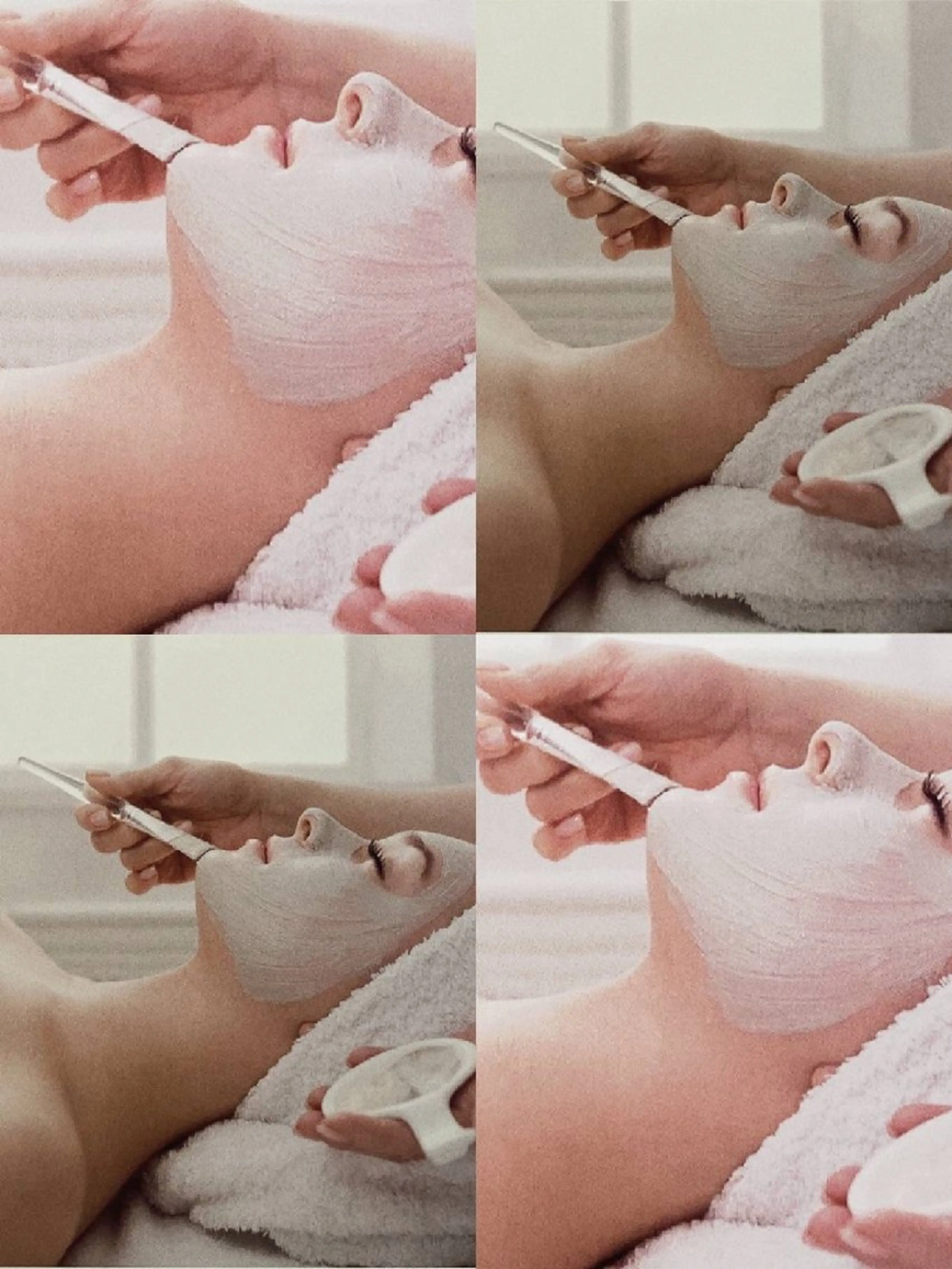 🌿ニキビ削除コース🌿の写真