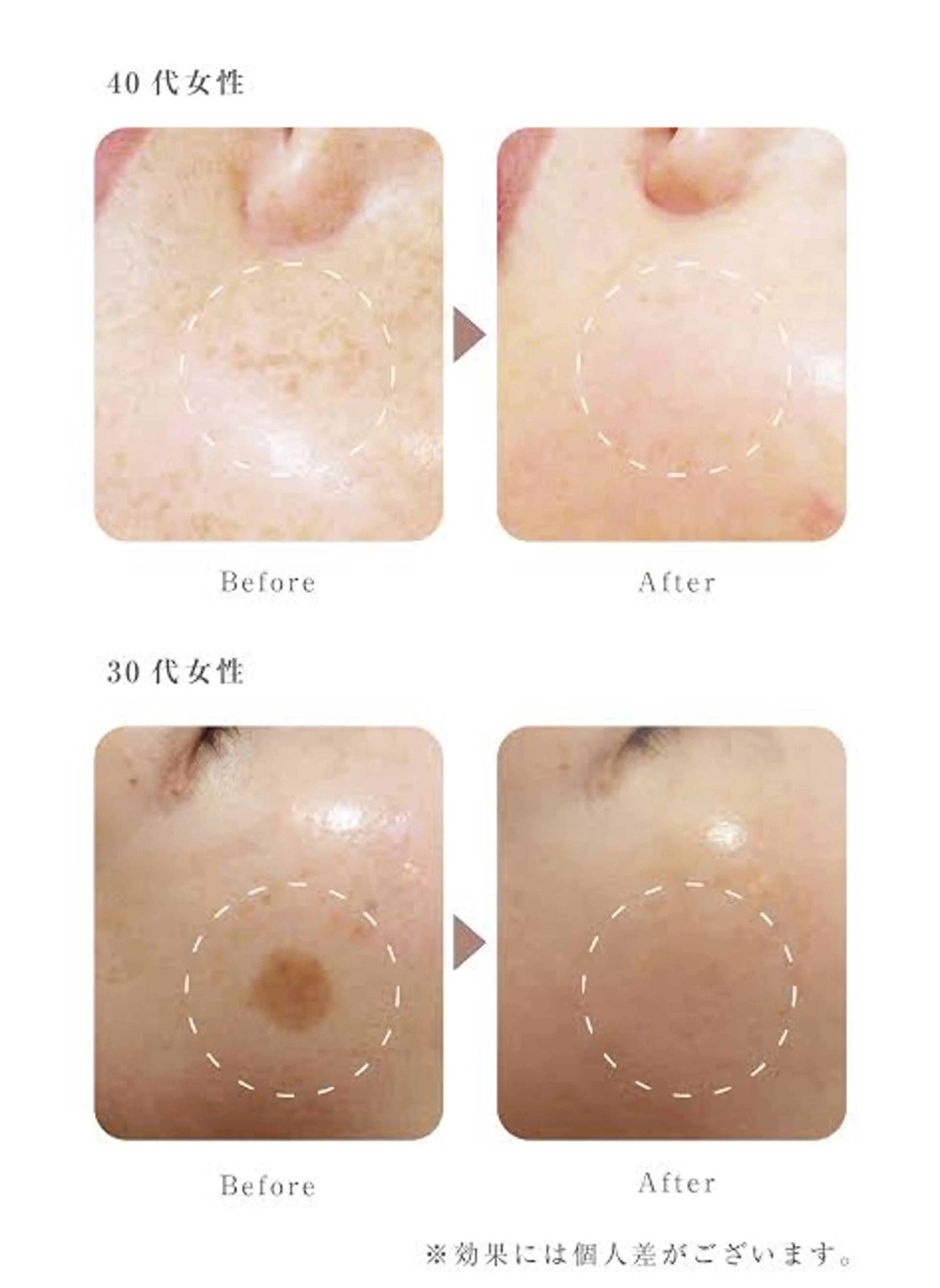 Lassy Yuriの眉毛・アイブロウイメージ