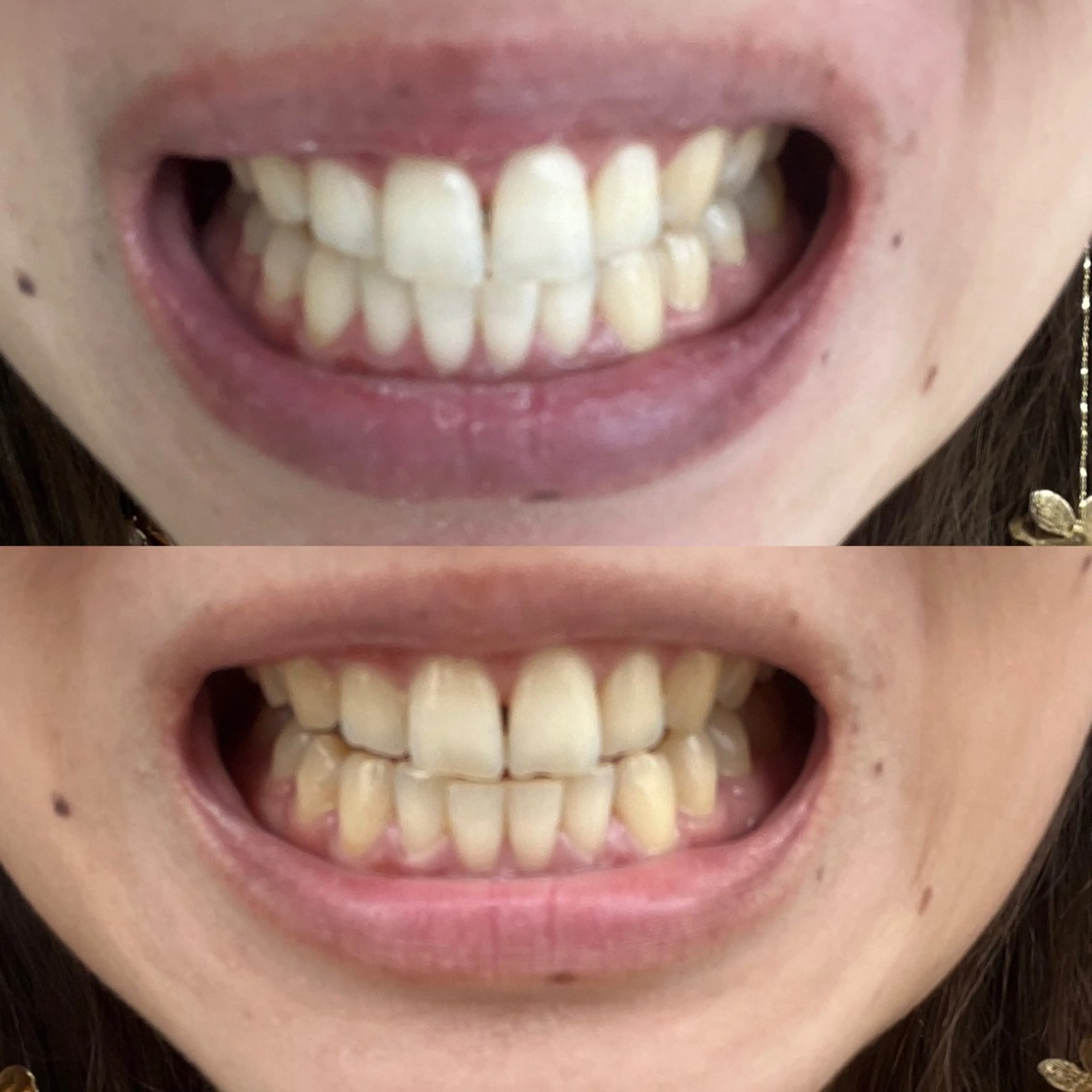 その他 nanami -ホワイトニングのその他イメージ