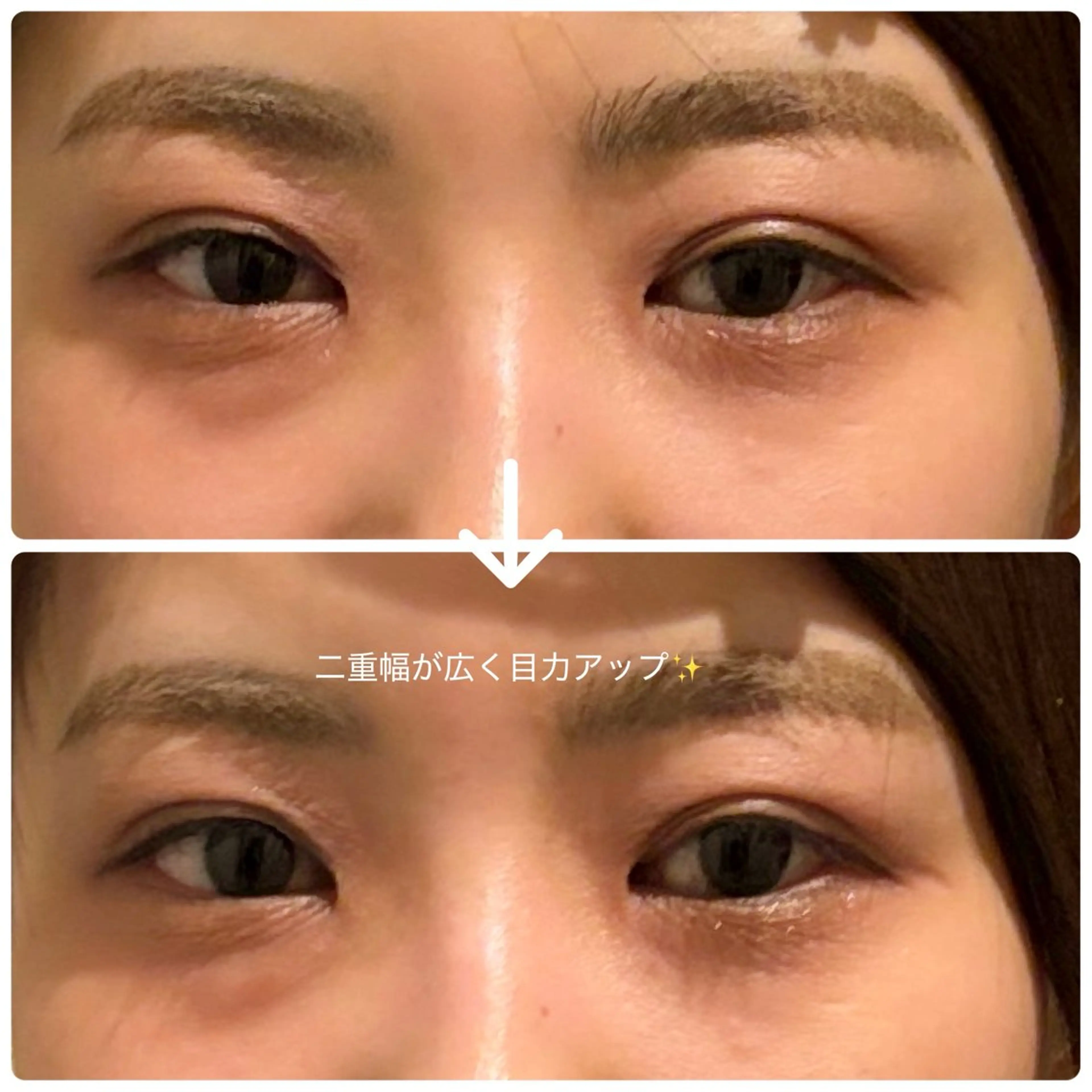 健康×美容鍼鍼灸院 あさば整体院三ノ輪店のエステ・リラクイメージ