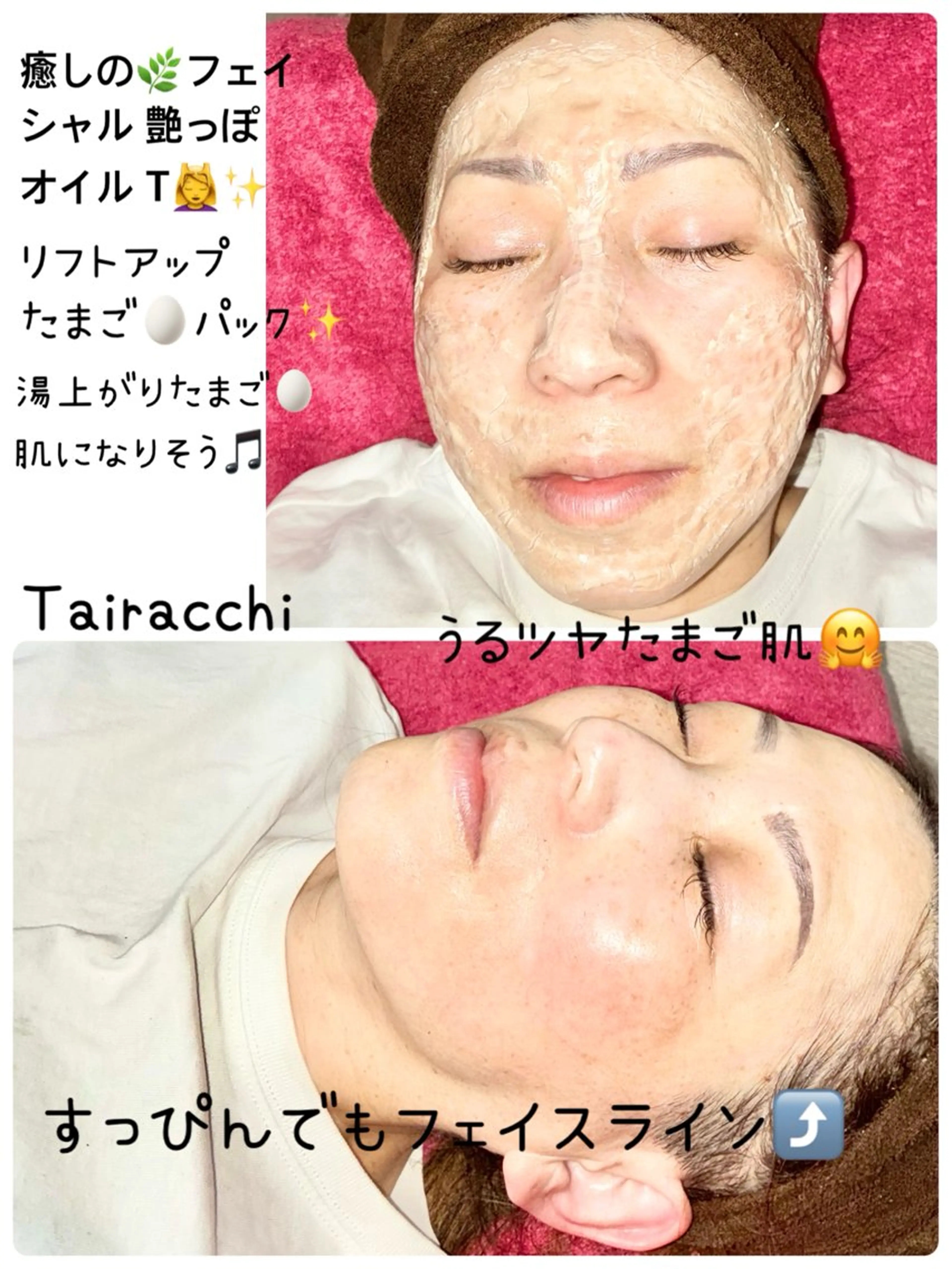 エステ Tairacchi タイラッチのネイルデザイン