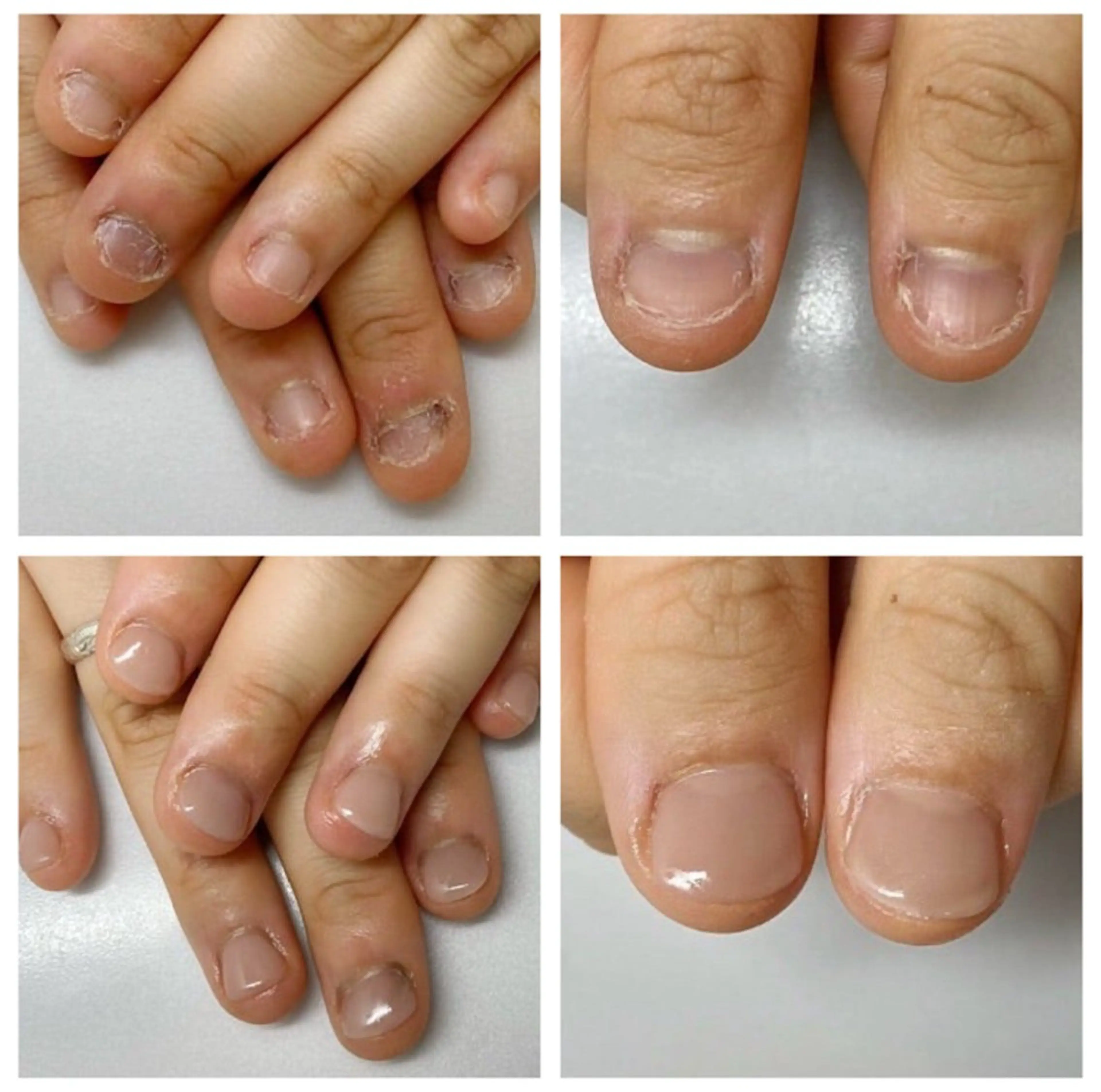 ネイル ネイルサロン アリュームのネイルデザイン