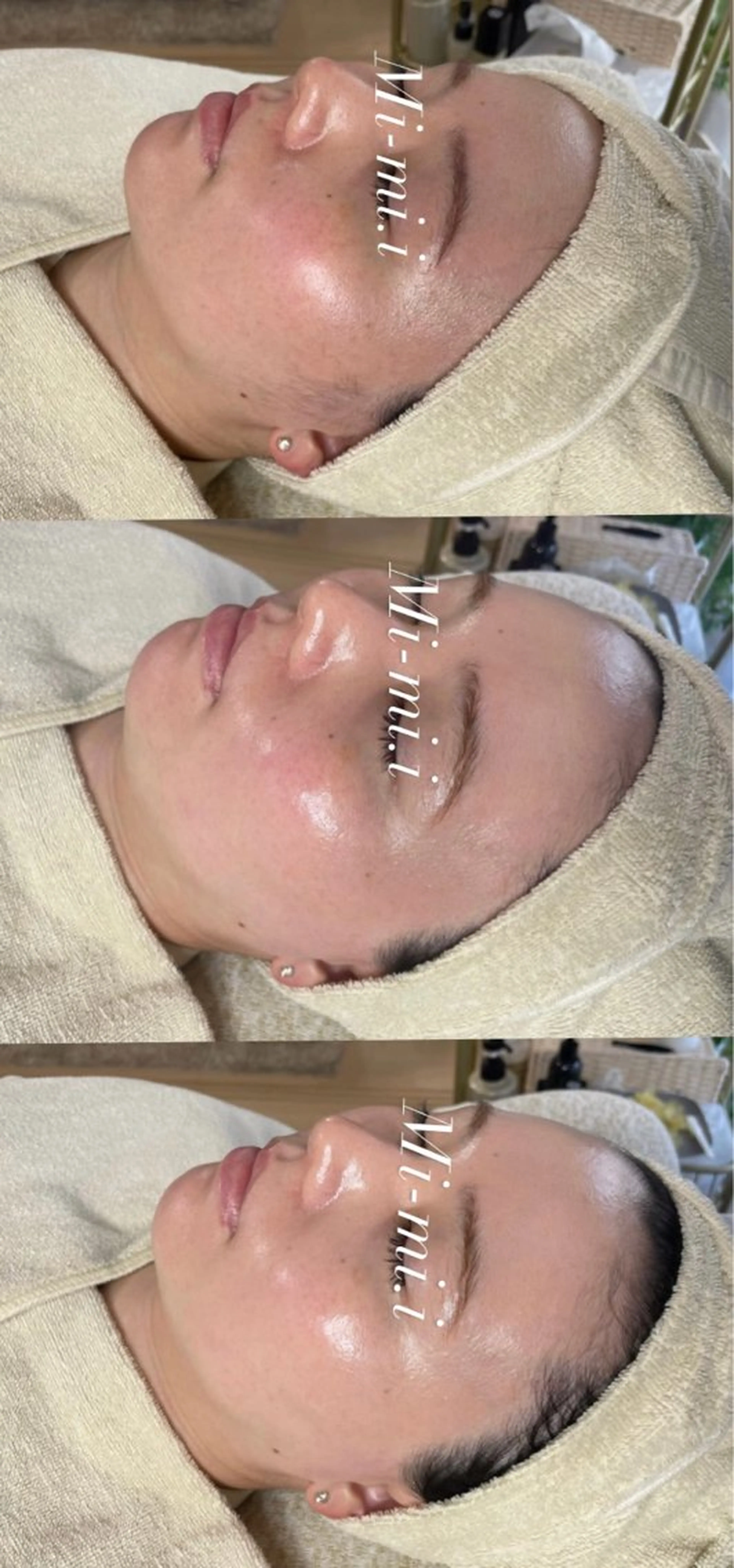 脱毛 エステサロン Mi-mi.iのエステ・リラクイメージ