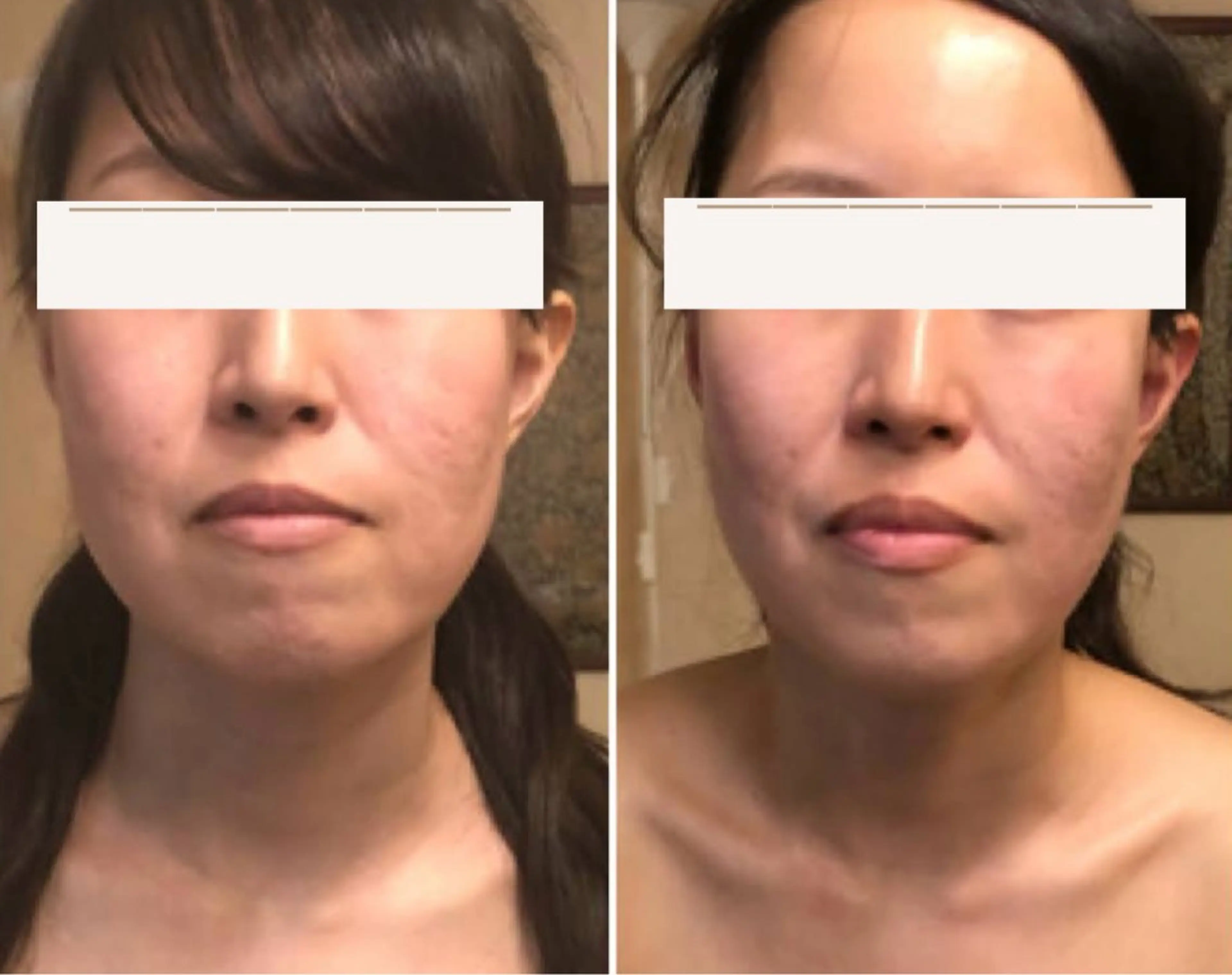 痩身/リラク 🎀KOZUKAのエステ・リラクイメージ