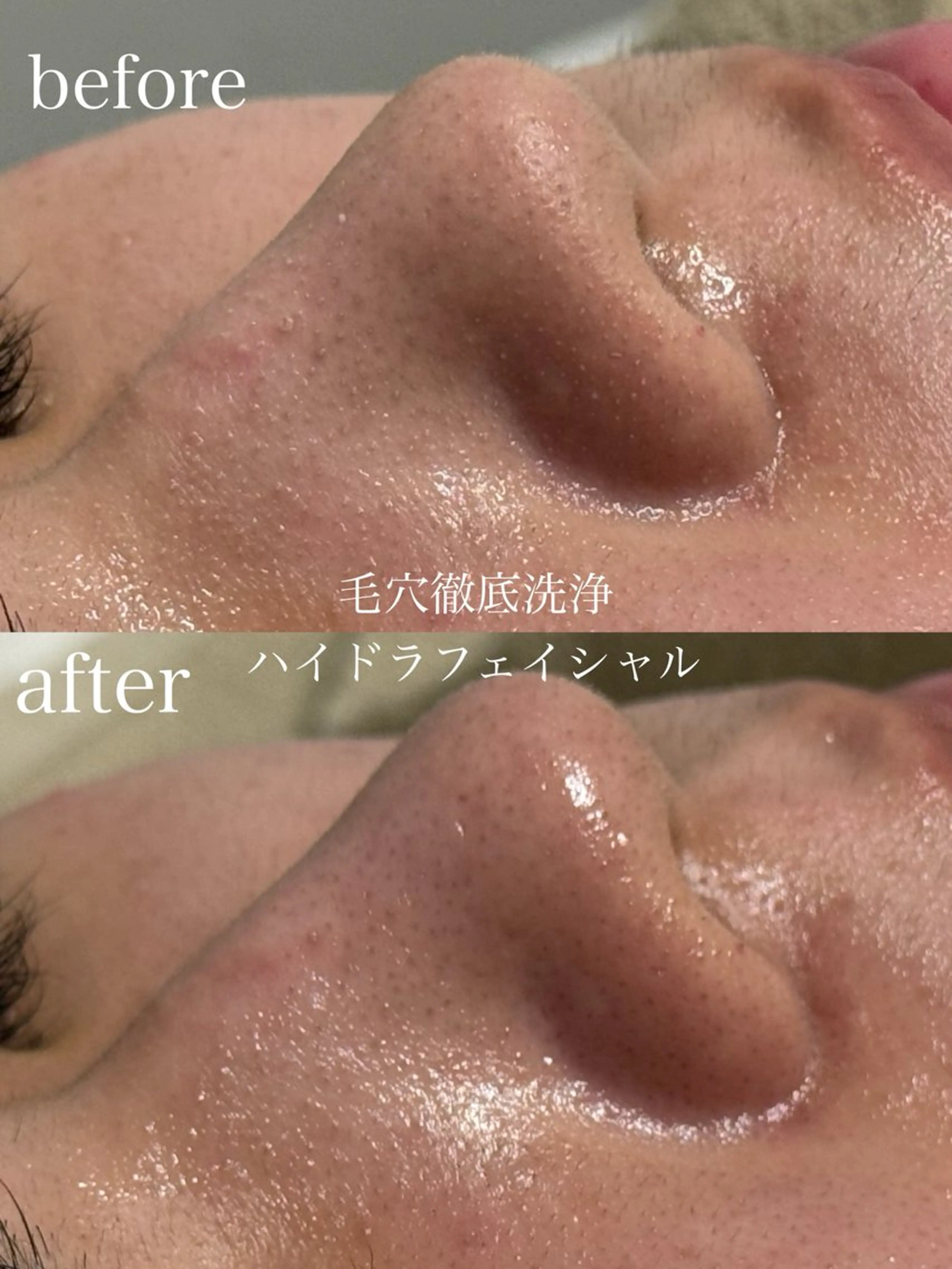 エステ フェイシャルサロン CHIARA鈴木のエステ・リラクイメージ