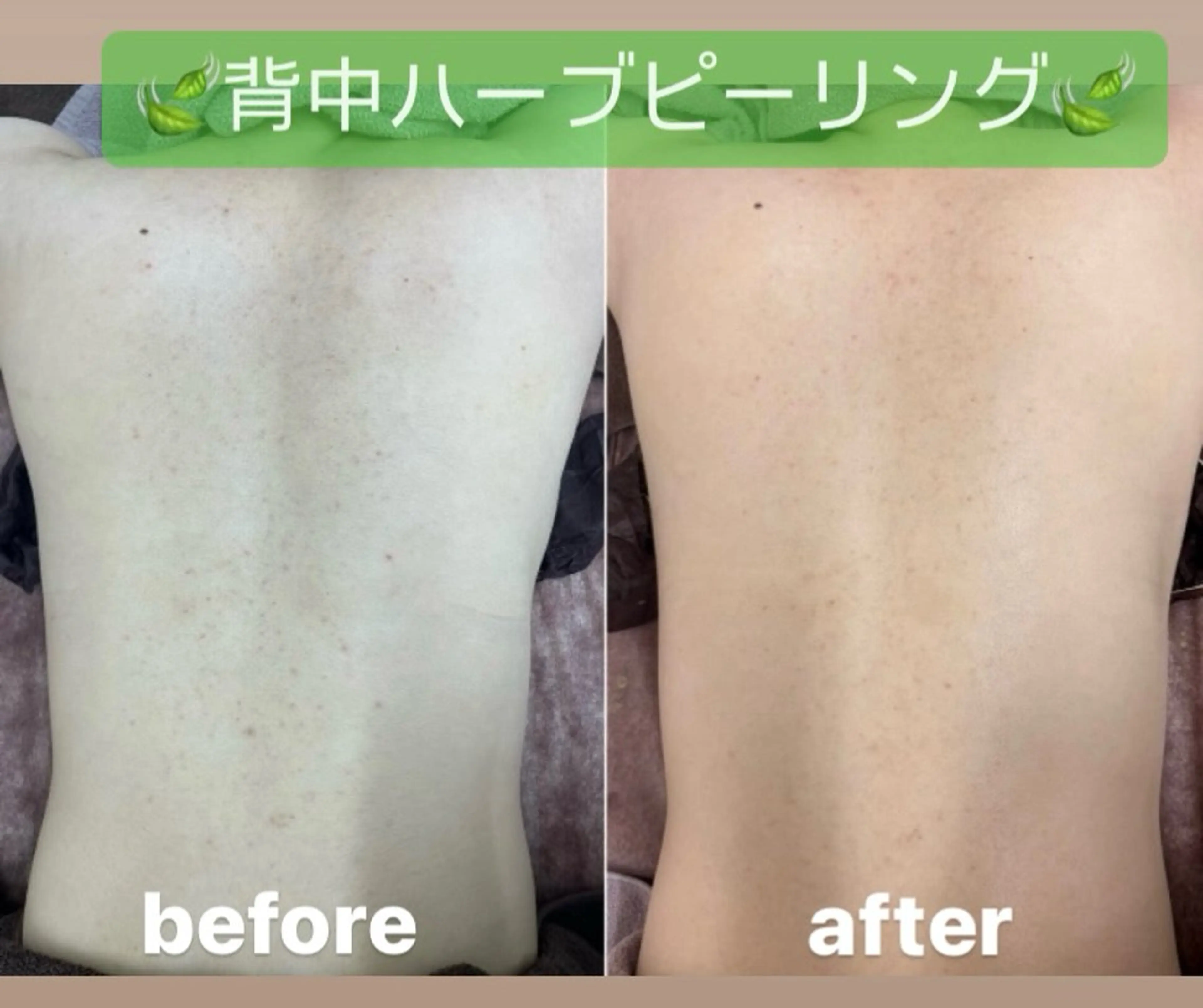 Tipani beaute'所属・Tipani beaute'のエステ・リラクイメージ