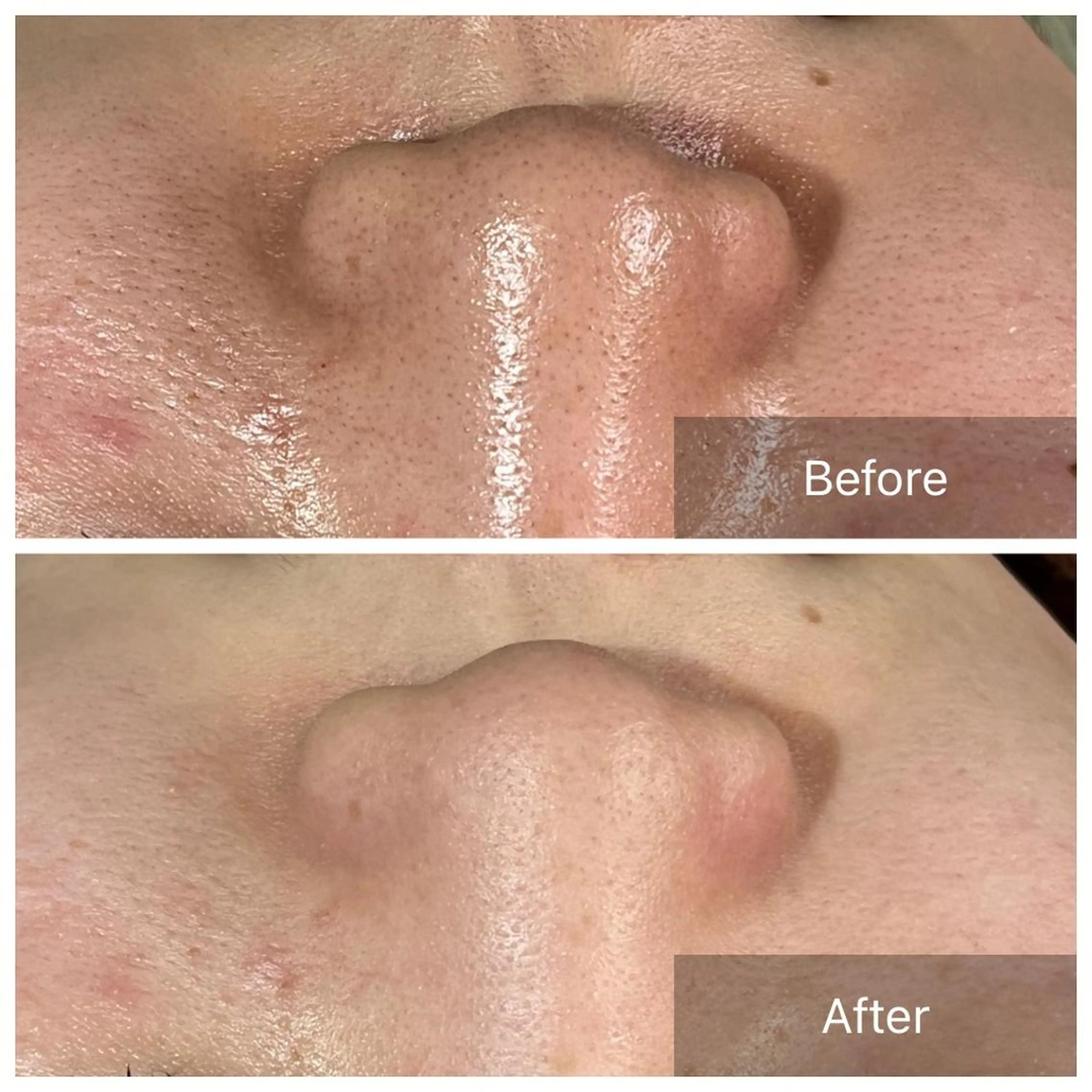 Laki  毛穴ケア とヘッドスパのサロンのエステ・リラクイメージ