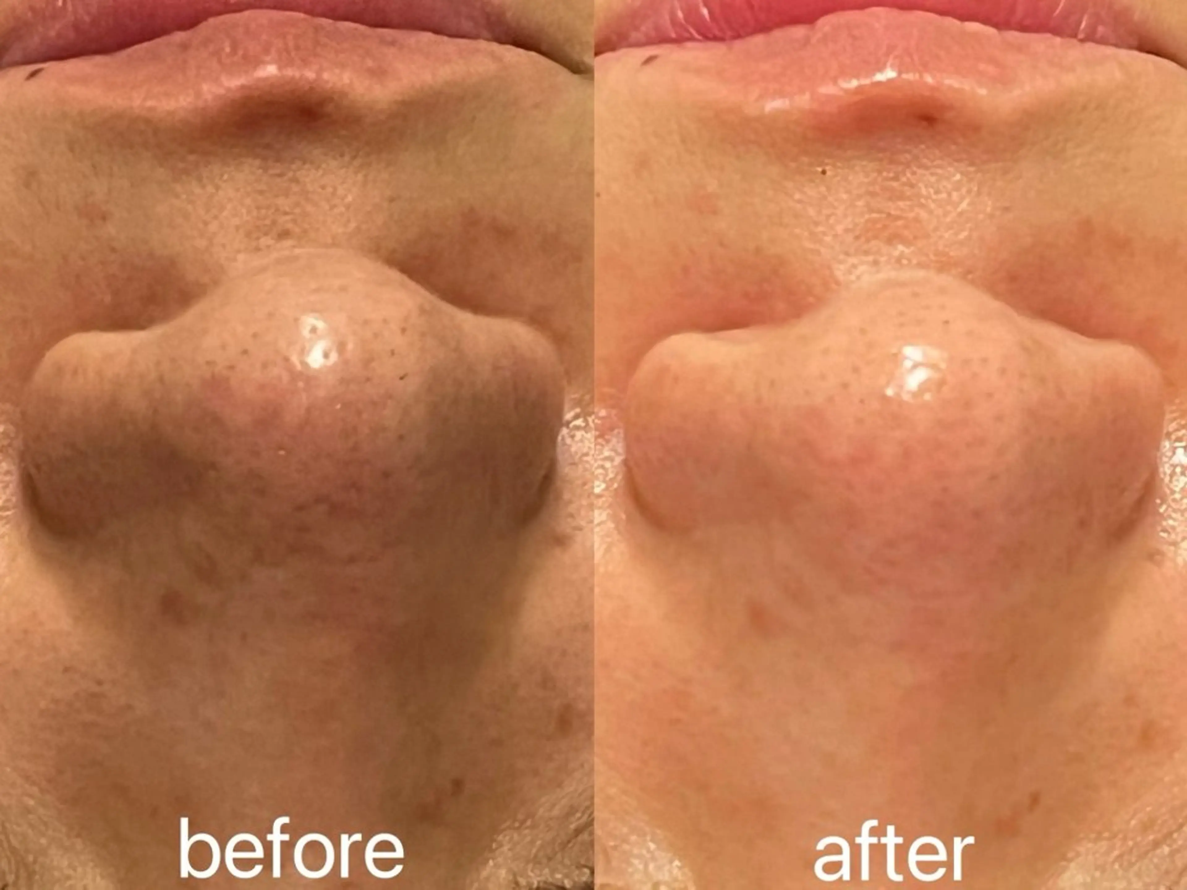 エステ 小顔＆まつ毛サロン AKANE❤️のエステ・リラクイメージ