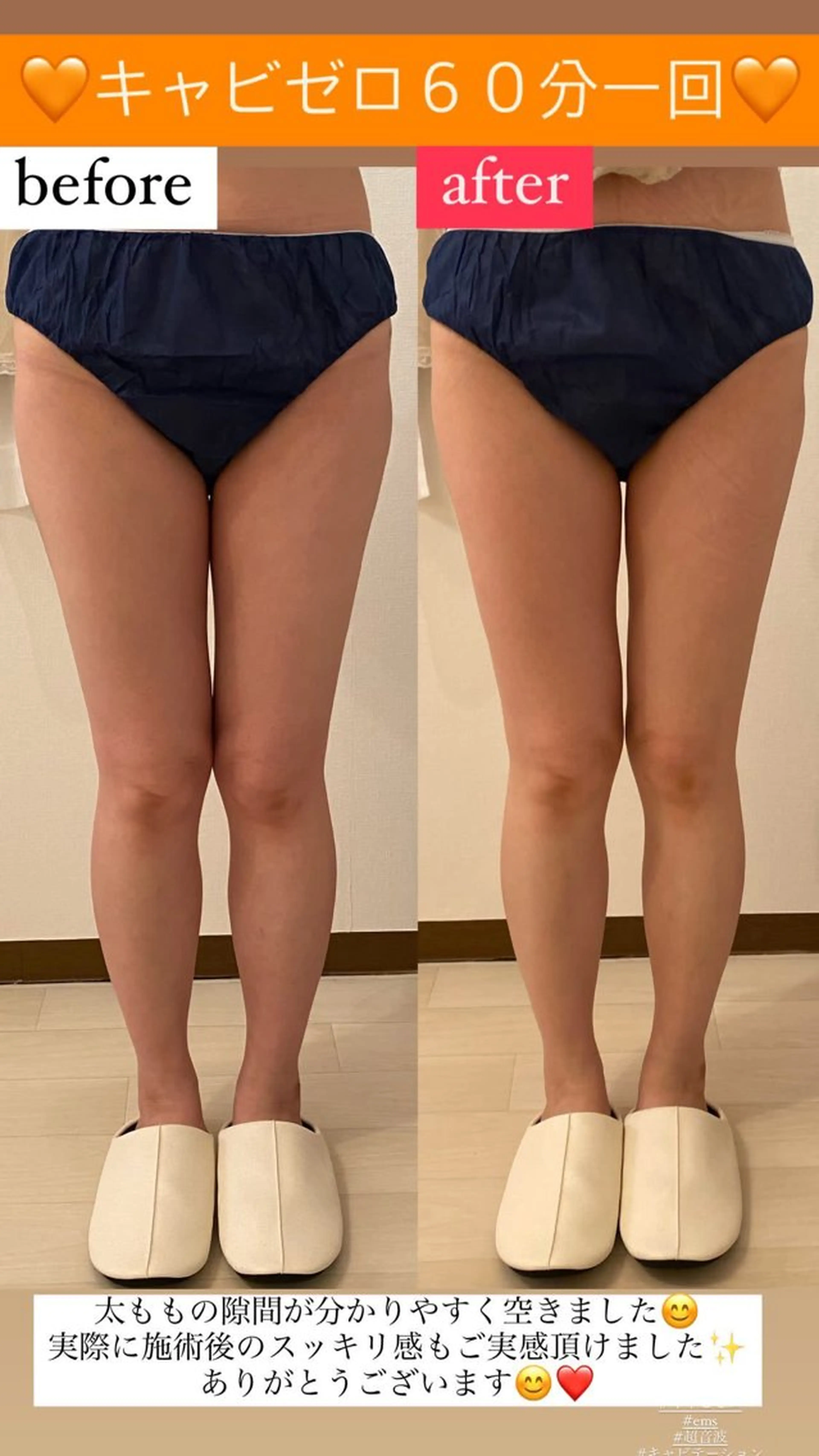 エステ リラク Salon de Lino 御器所のエステ・リラクイメージ