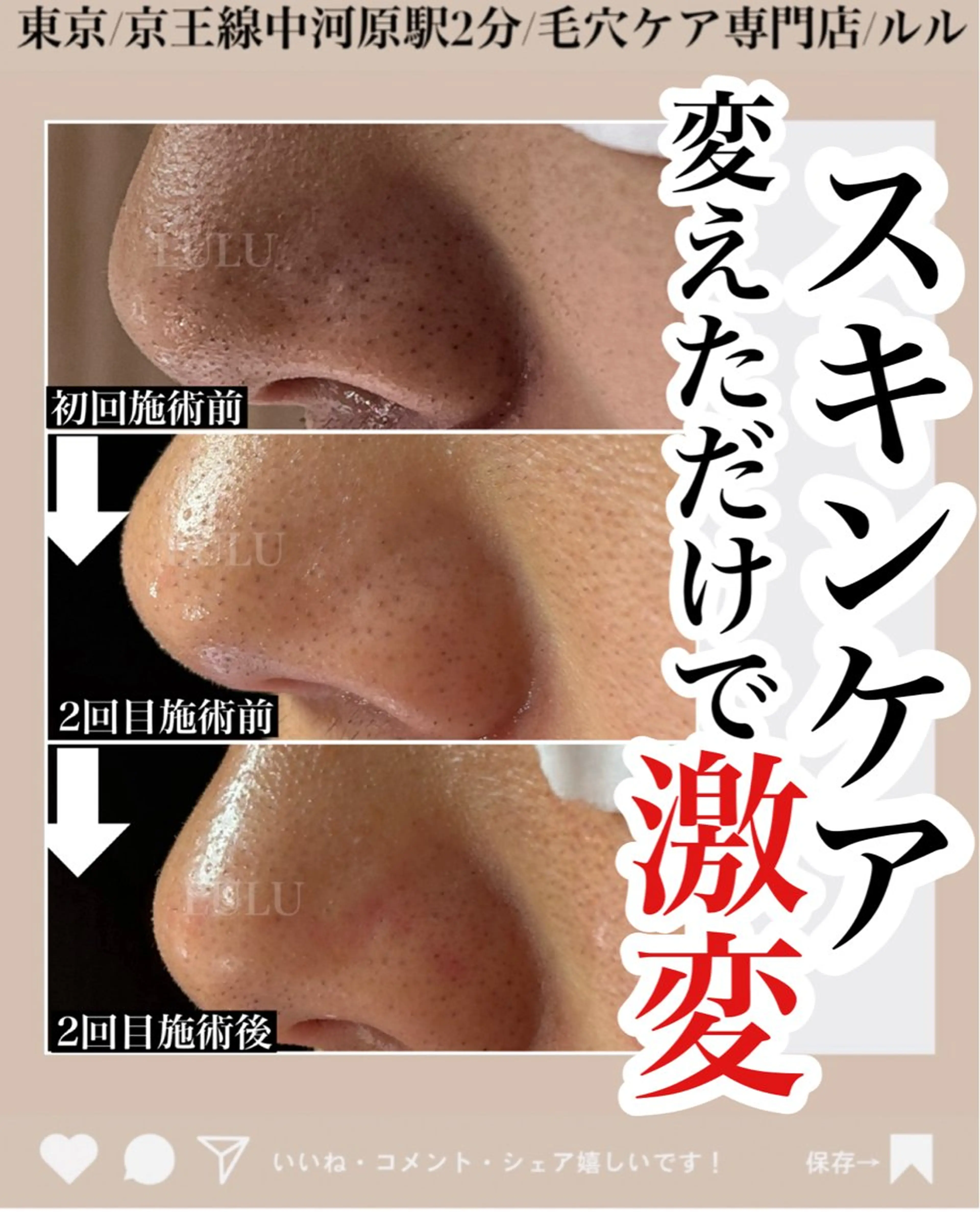 エステ LULU ルルのエステ・リラクイメージ