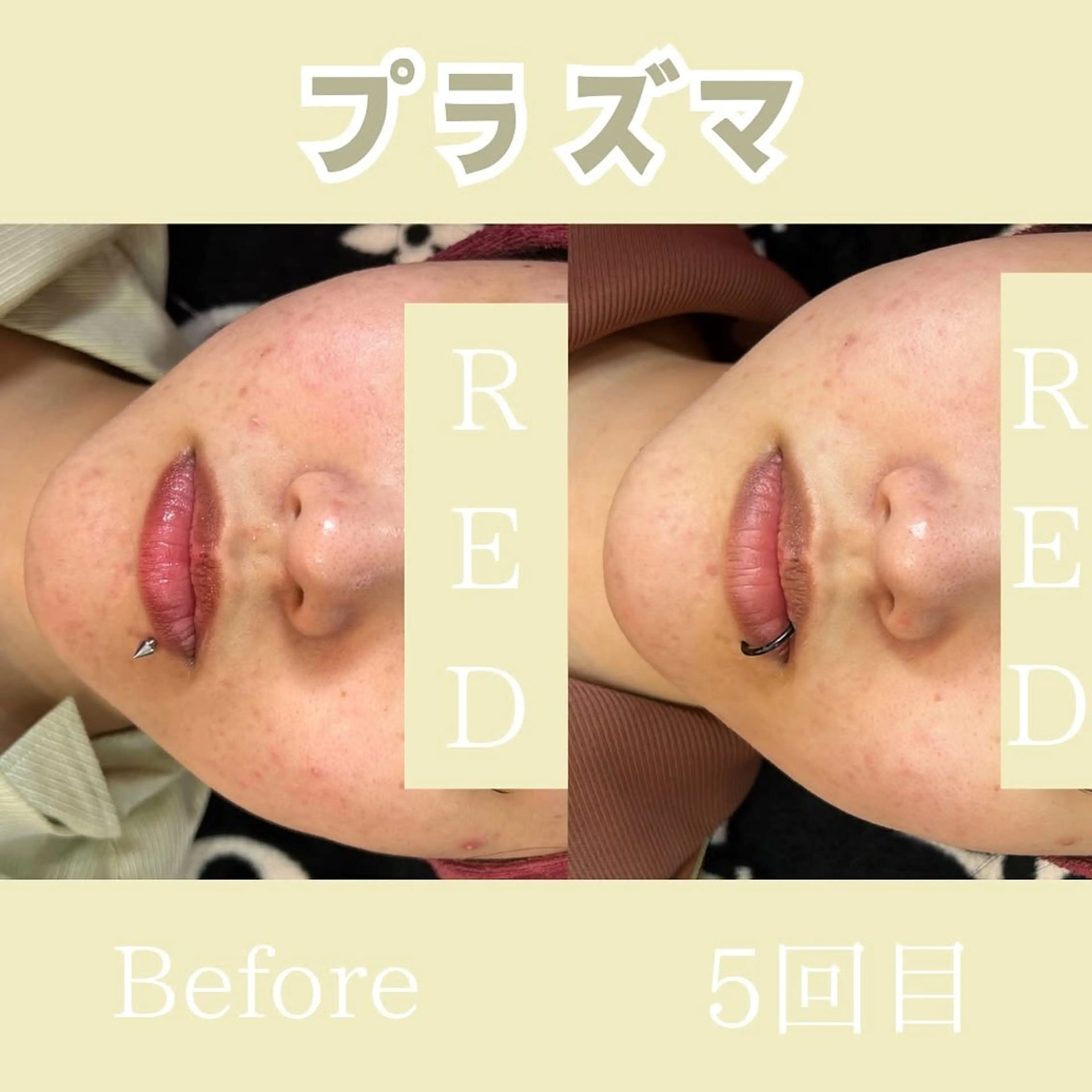 小顔矯正専門店 【RED】池田のエステ・リラクイメージ