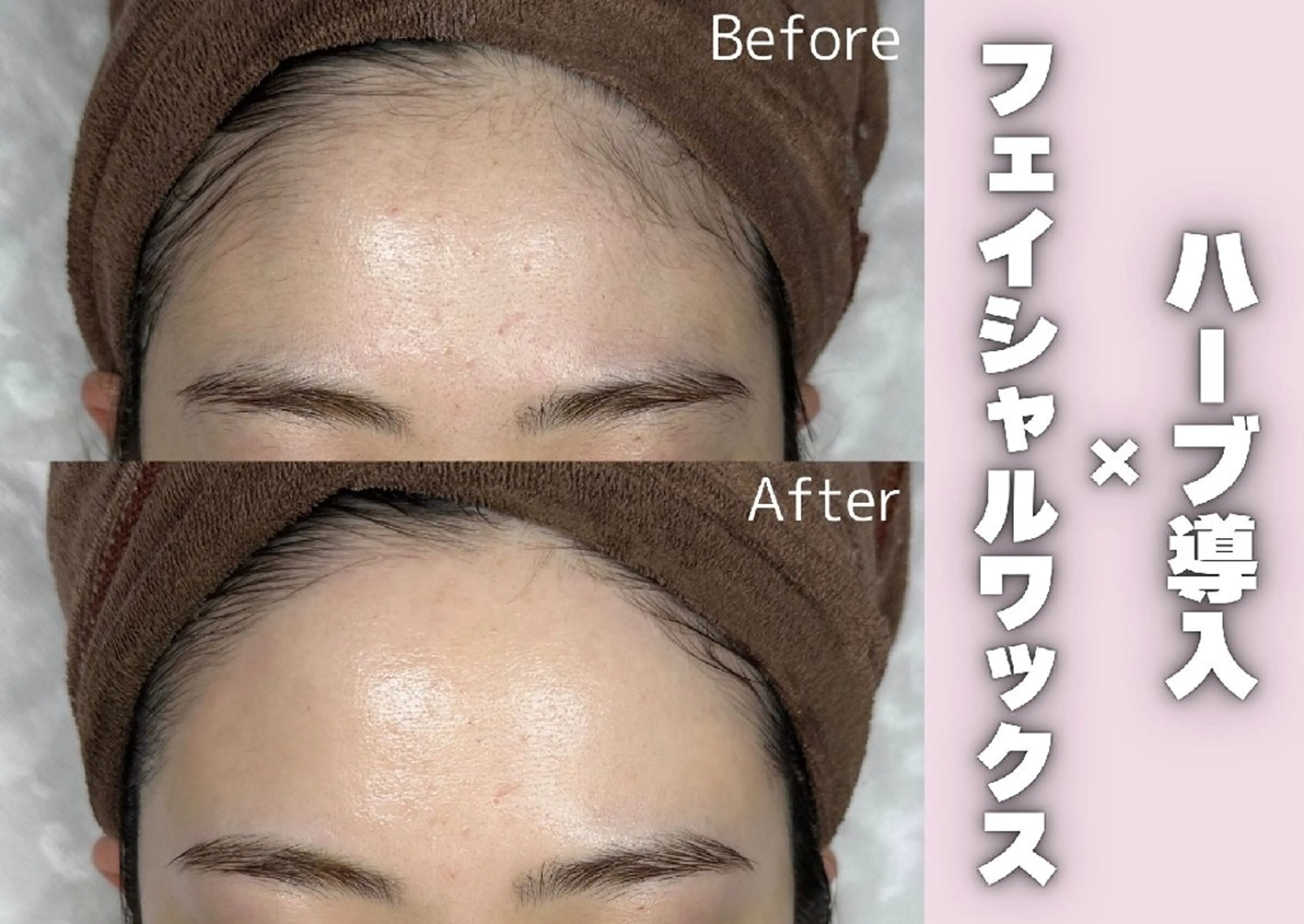 モン エピレなんば店のエステ・リラクイメージ