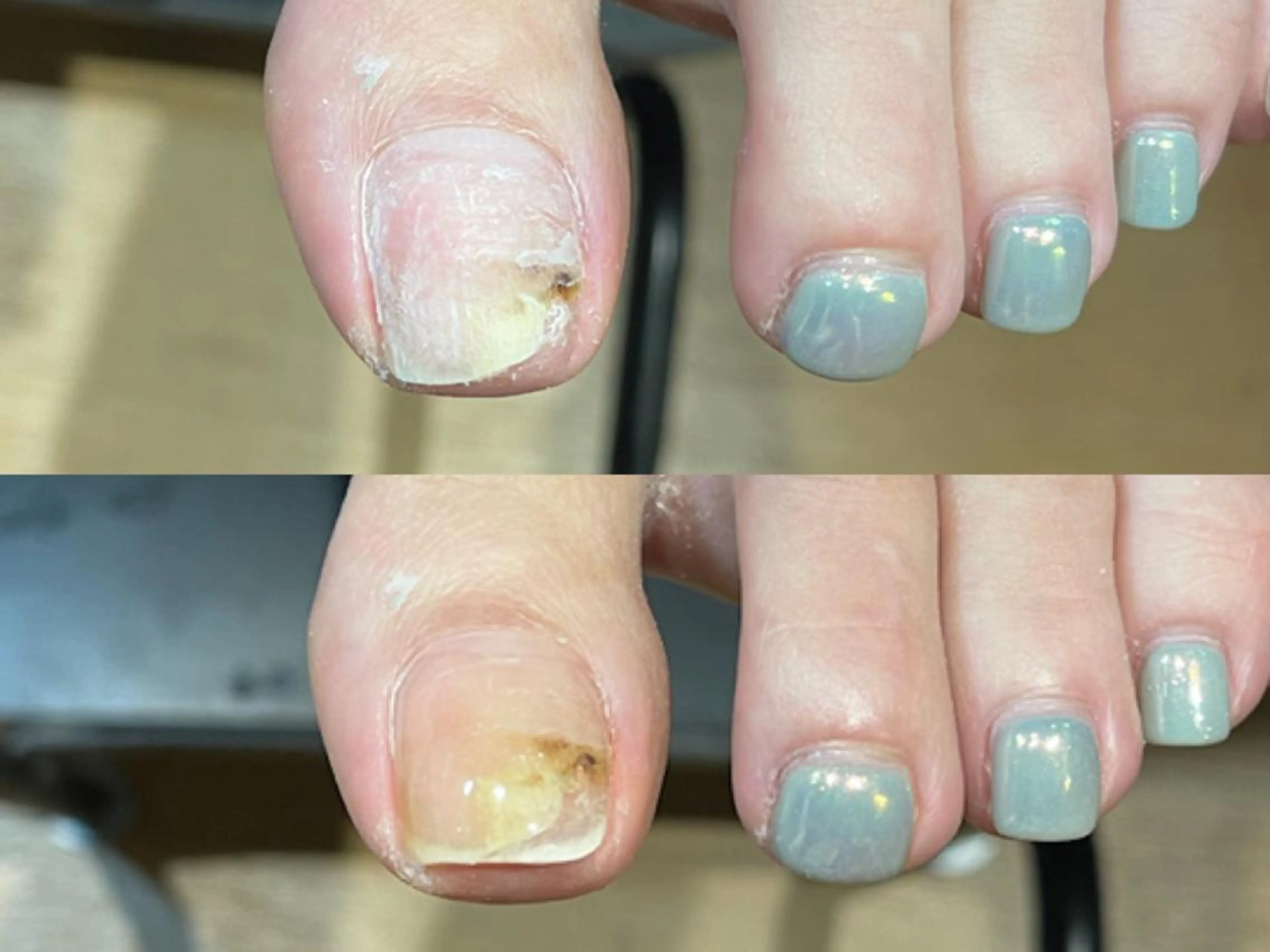 ネイル cachette mのネイルデザイン