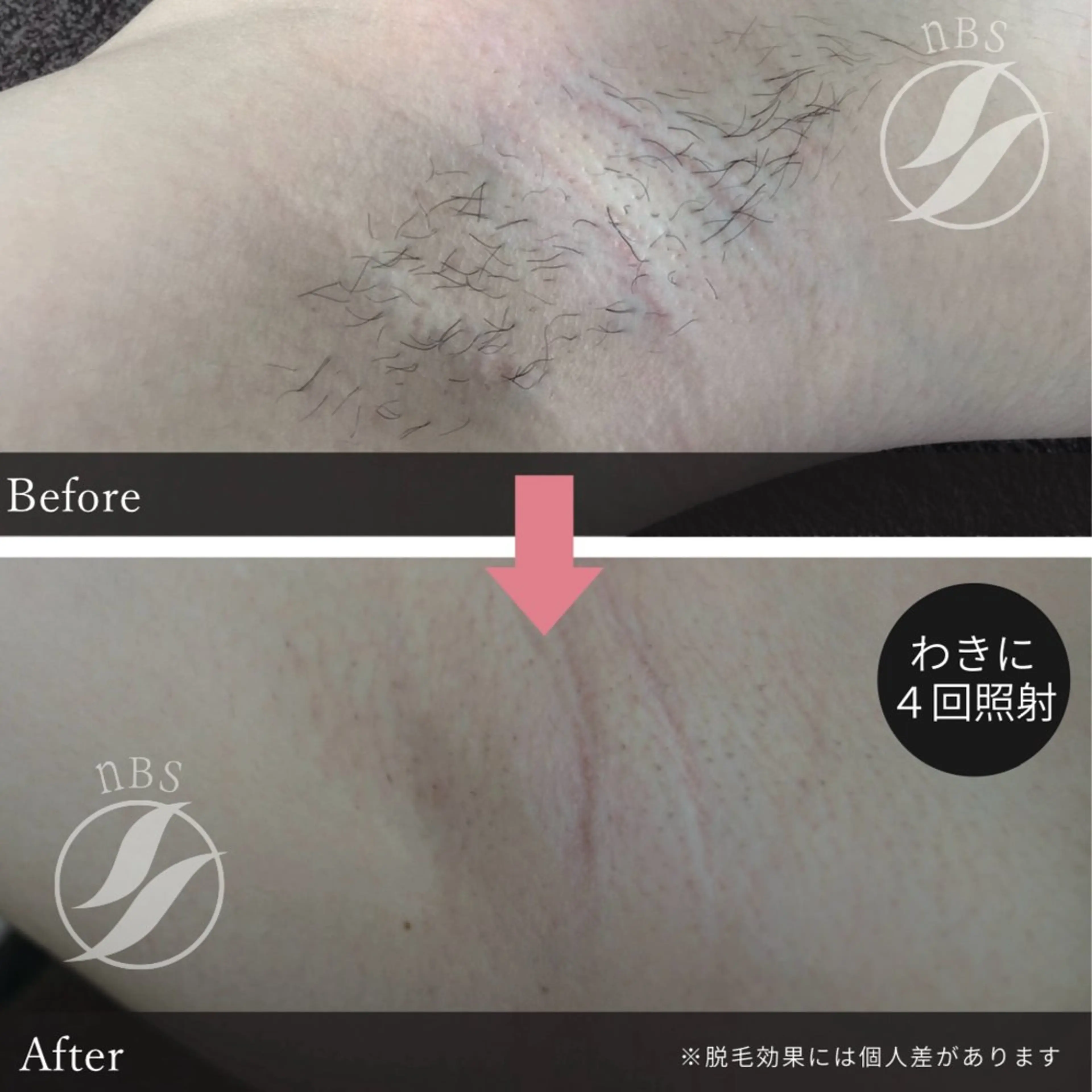 VIERU 🌈🎀💖のネイルデザイン