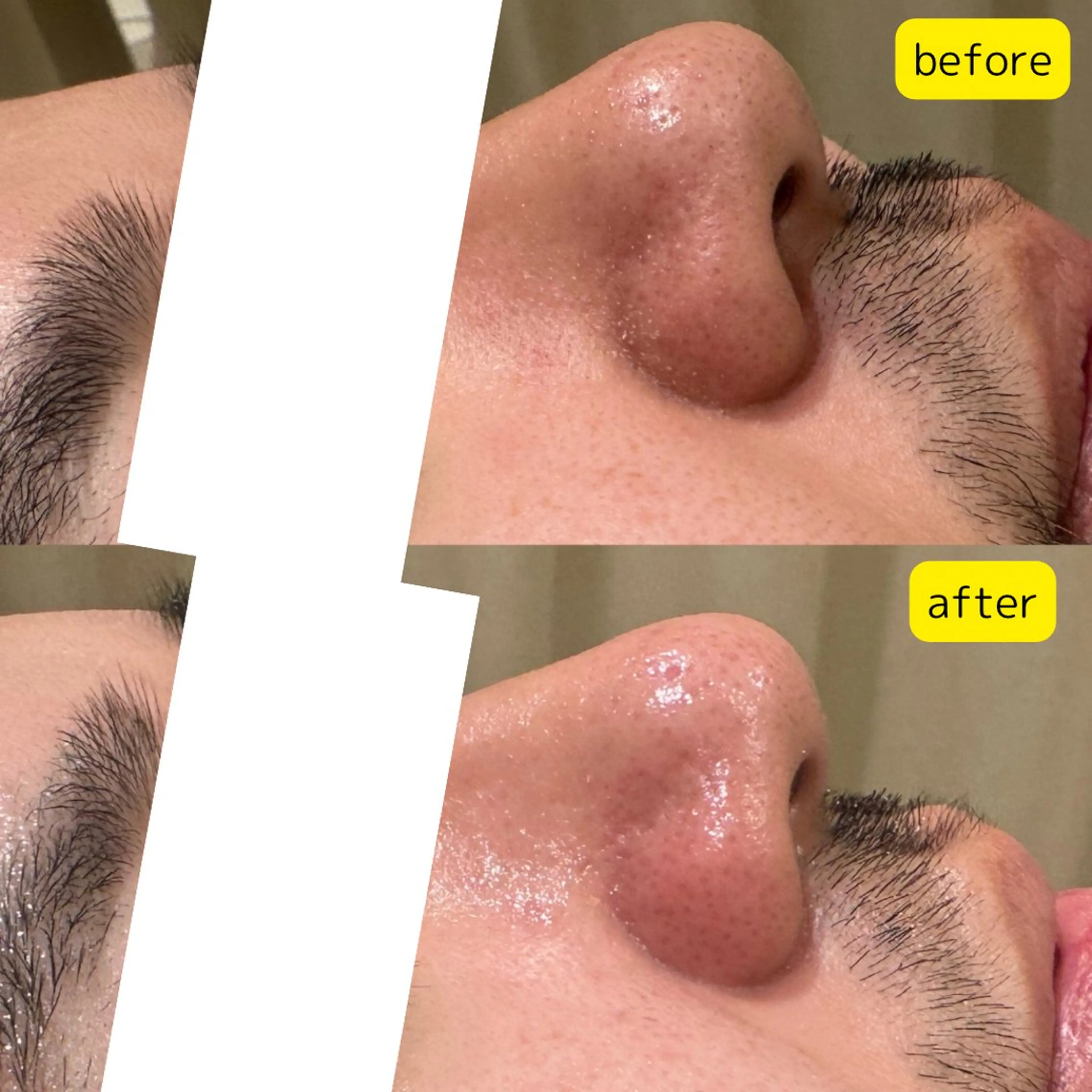 【メンズ限定👨🏻】3/31まで★初めての方も安心！フェイシャルエステトータルケア◎髭は剃ってくることをお勧め‼️の写真