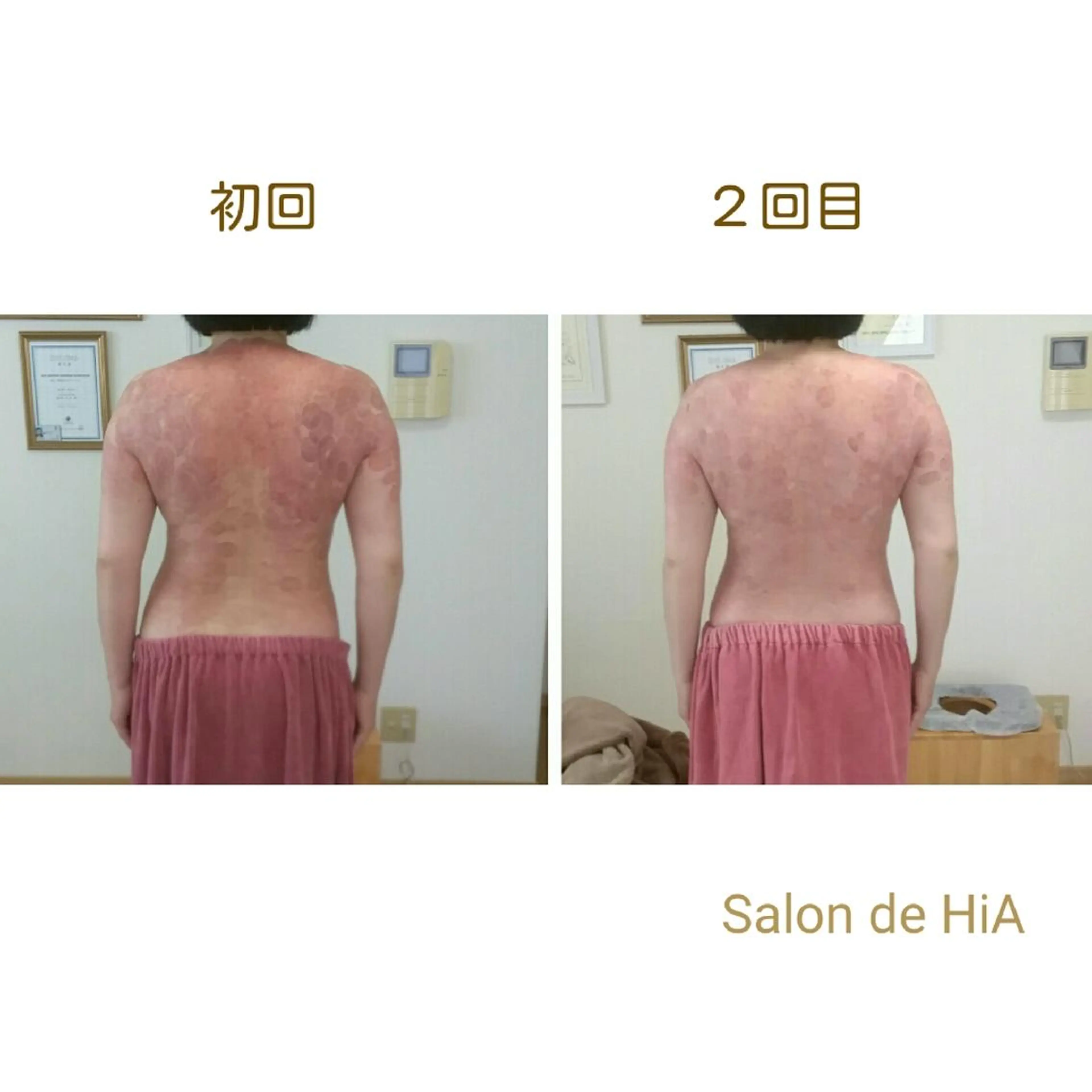 エステ リラク Salon de  HiAのエステ・リラクイメージ