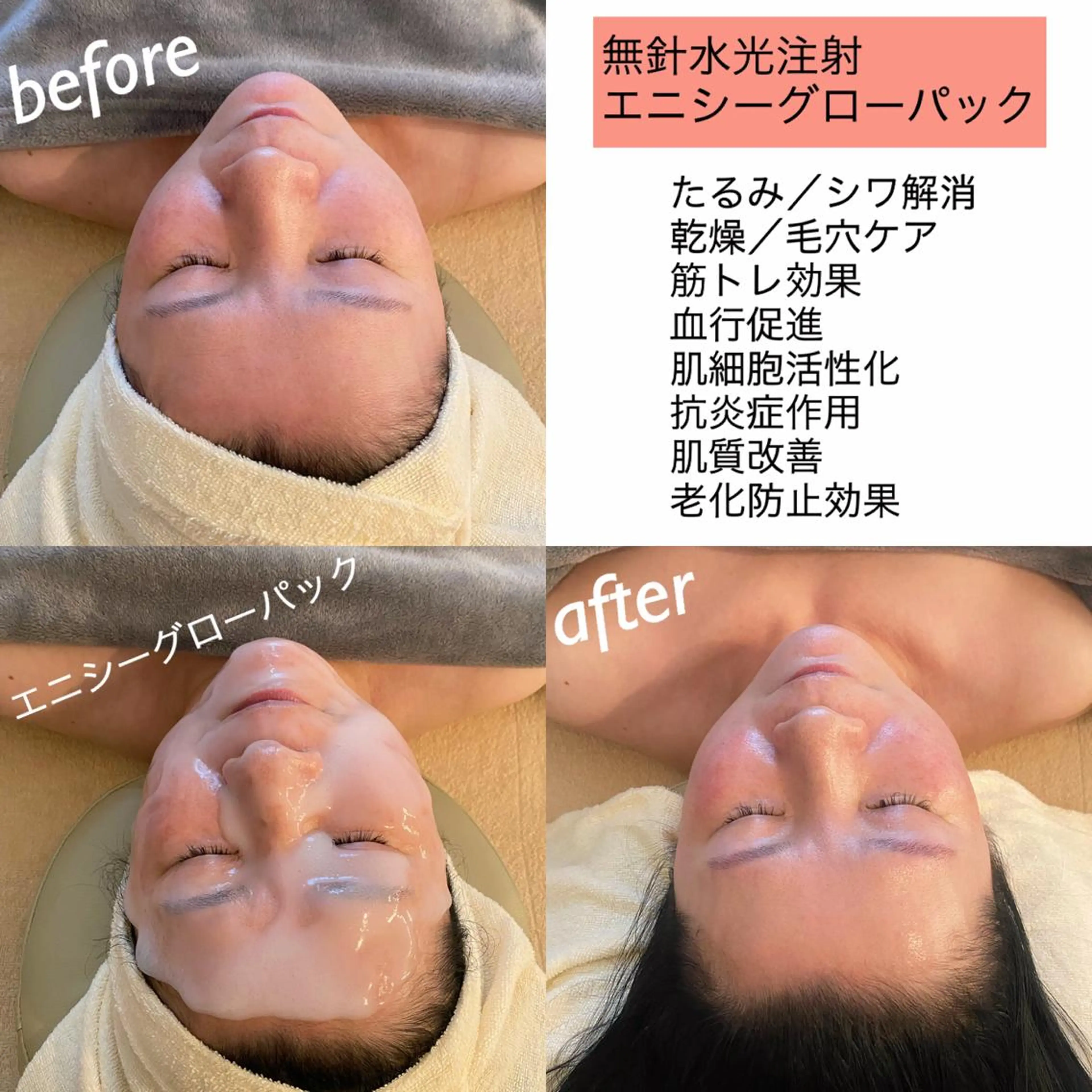 うなじ脱毛/美肌脱毛 LABELのエステ・リラクイメージ