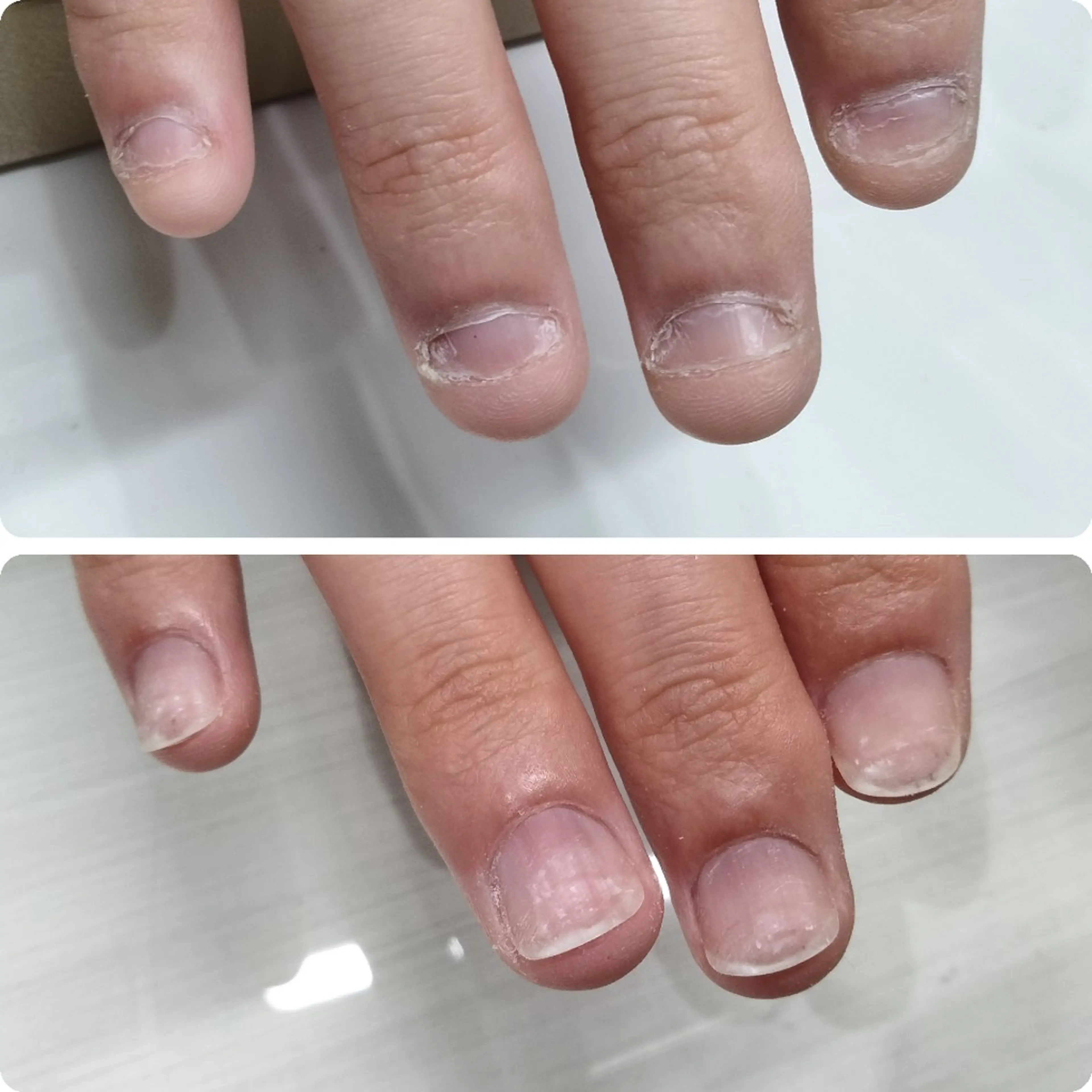 ネイル ネイルサロン アリュームのネイルデザイン