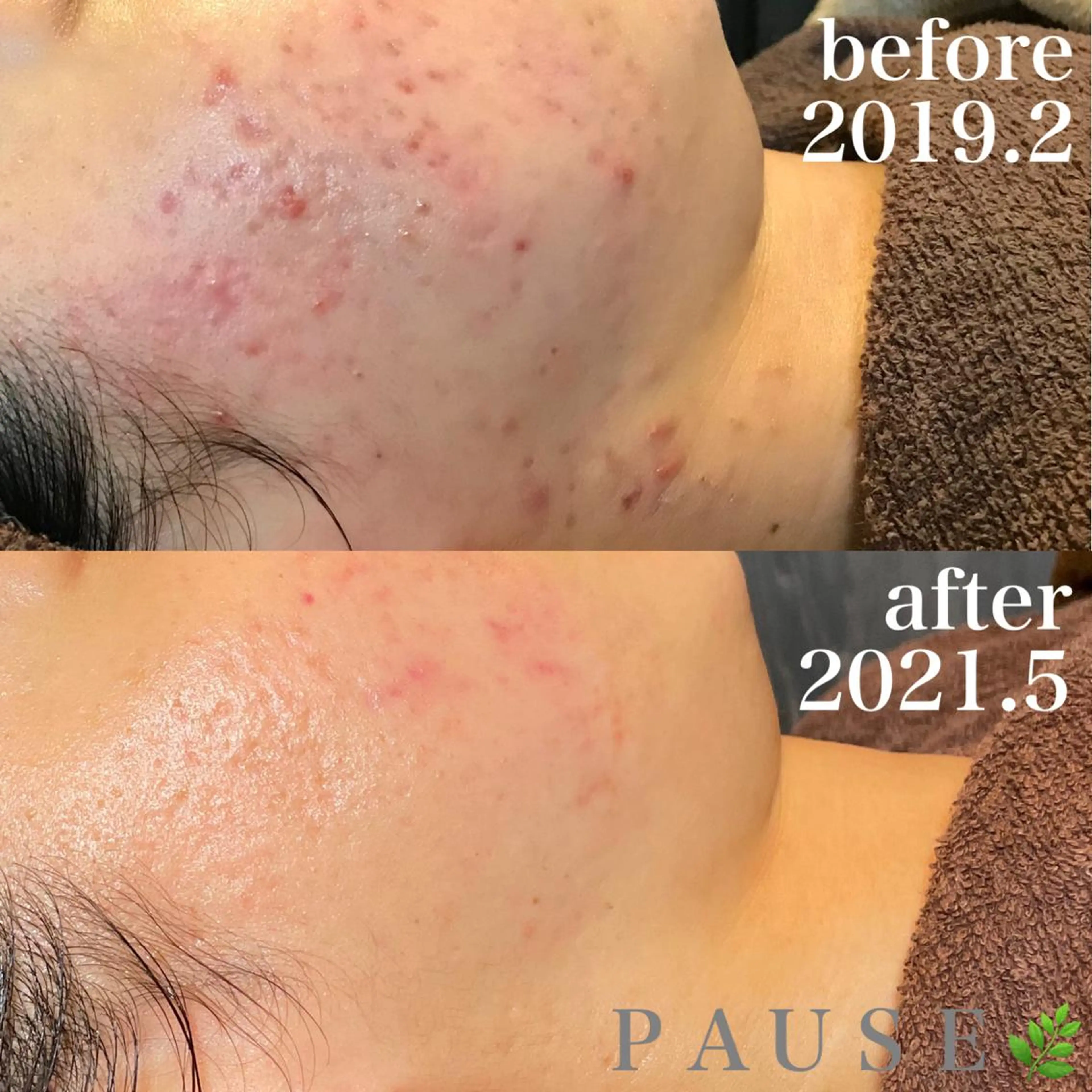 エステ 浜野 恵美のエステ・リラクイメージ