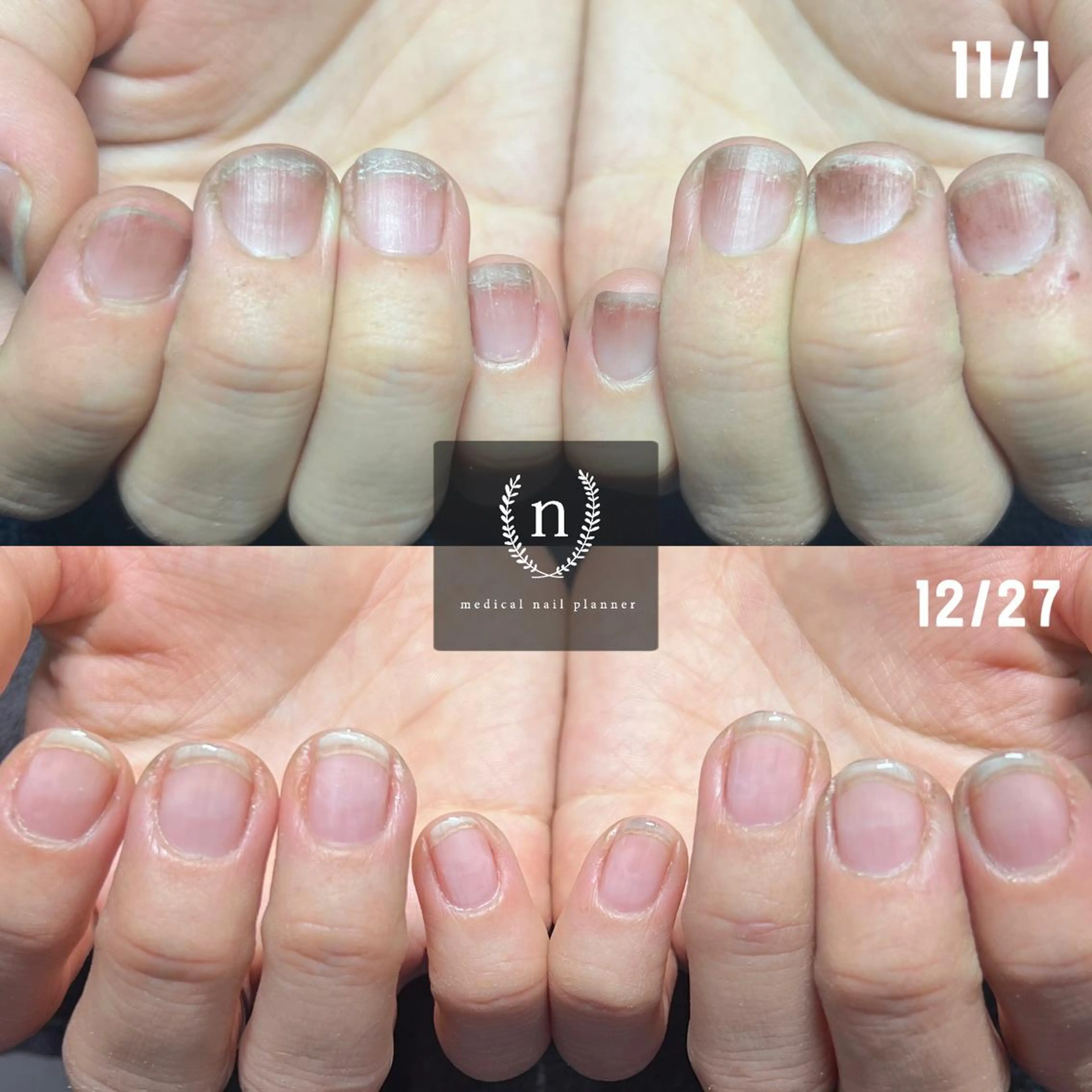 ネイル ハンドネイル ｎａｇｉ所属・自爪育成専門サロン ◌𓈒azumiのネイルデザイン