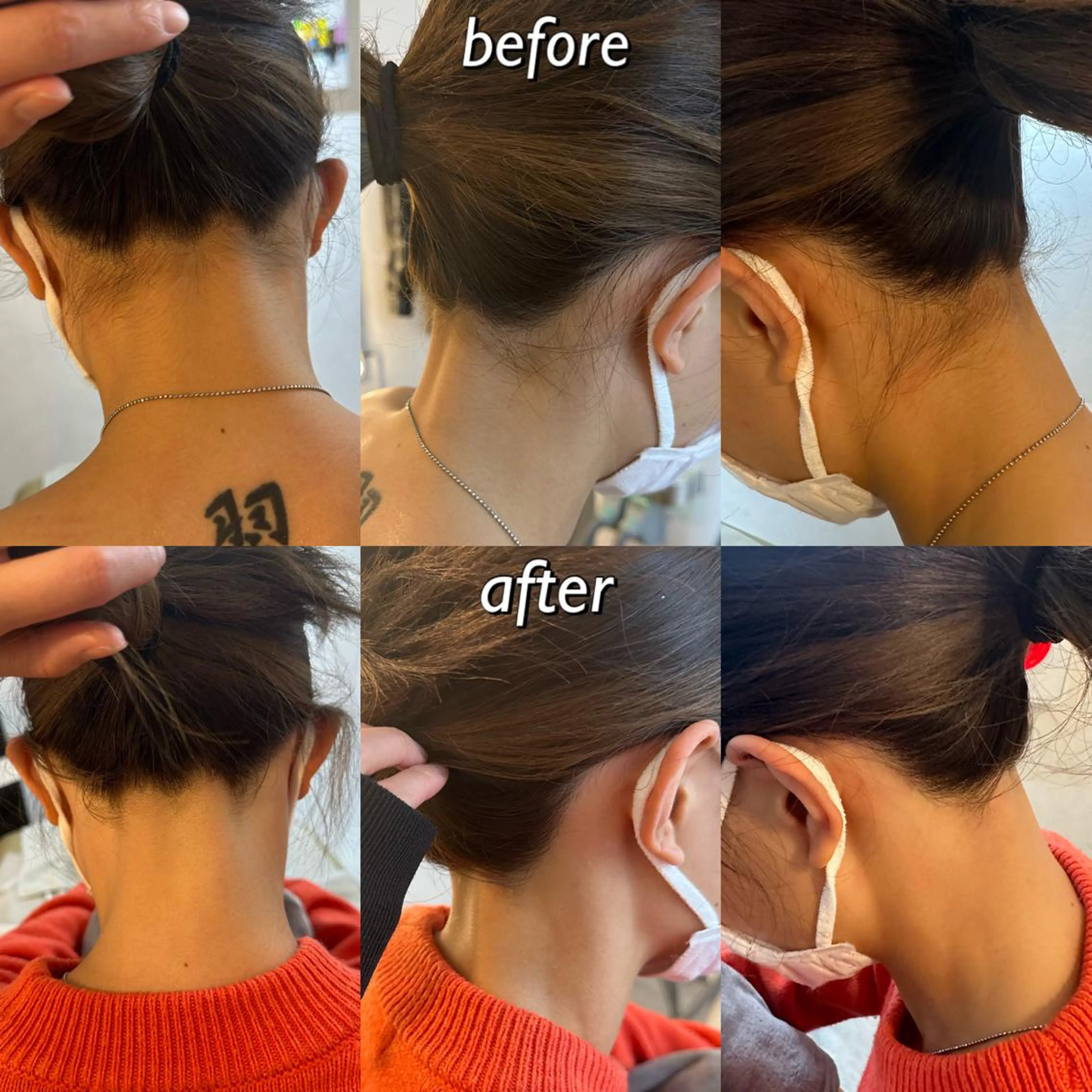 うなじ脱毛/美肌脱毛 LABELのエステ・リラクイメージ