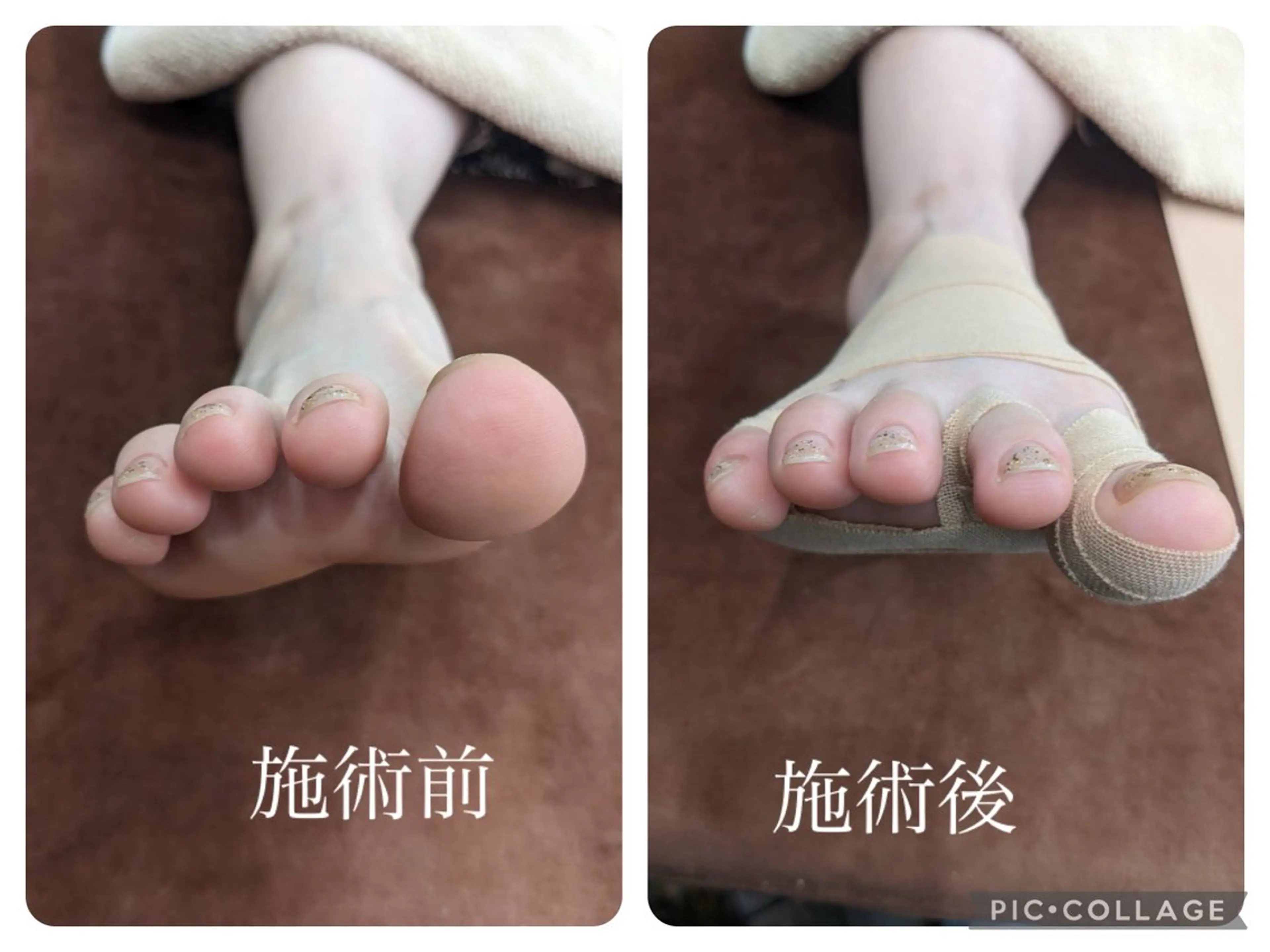 ミニモ価格⭐︎【足歪み、O脚、X脚、外反母趾ケア】足整体×足首矯正×美脚矯正45分の写真