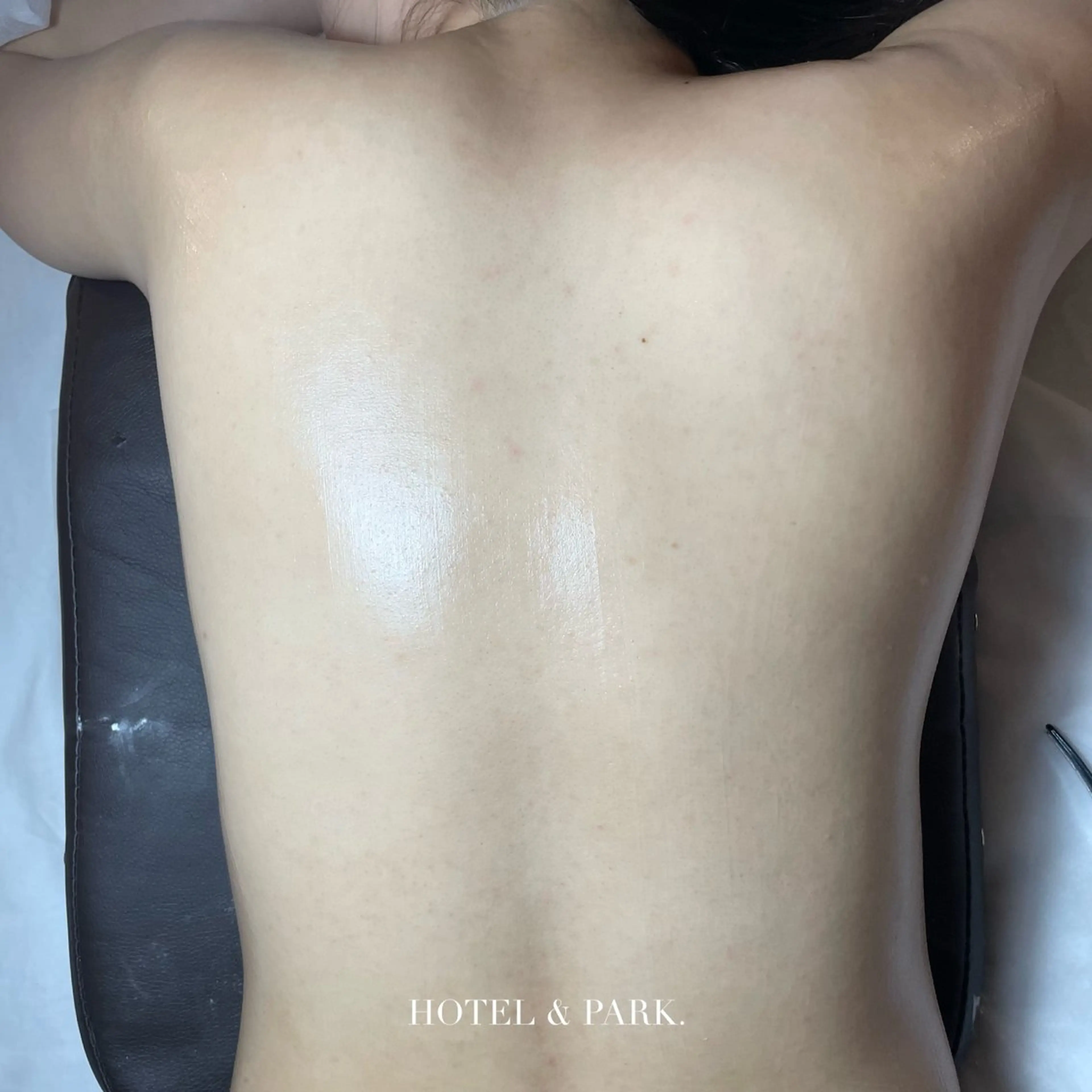 【背中ALL*うなじ込ワックス脱毛】の写真