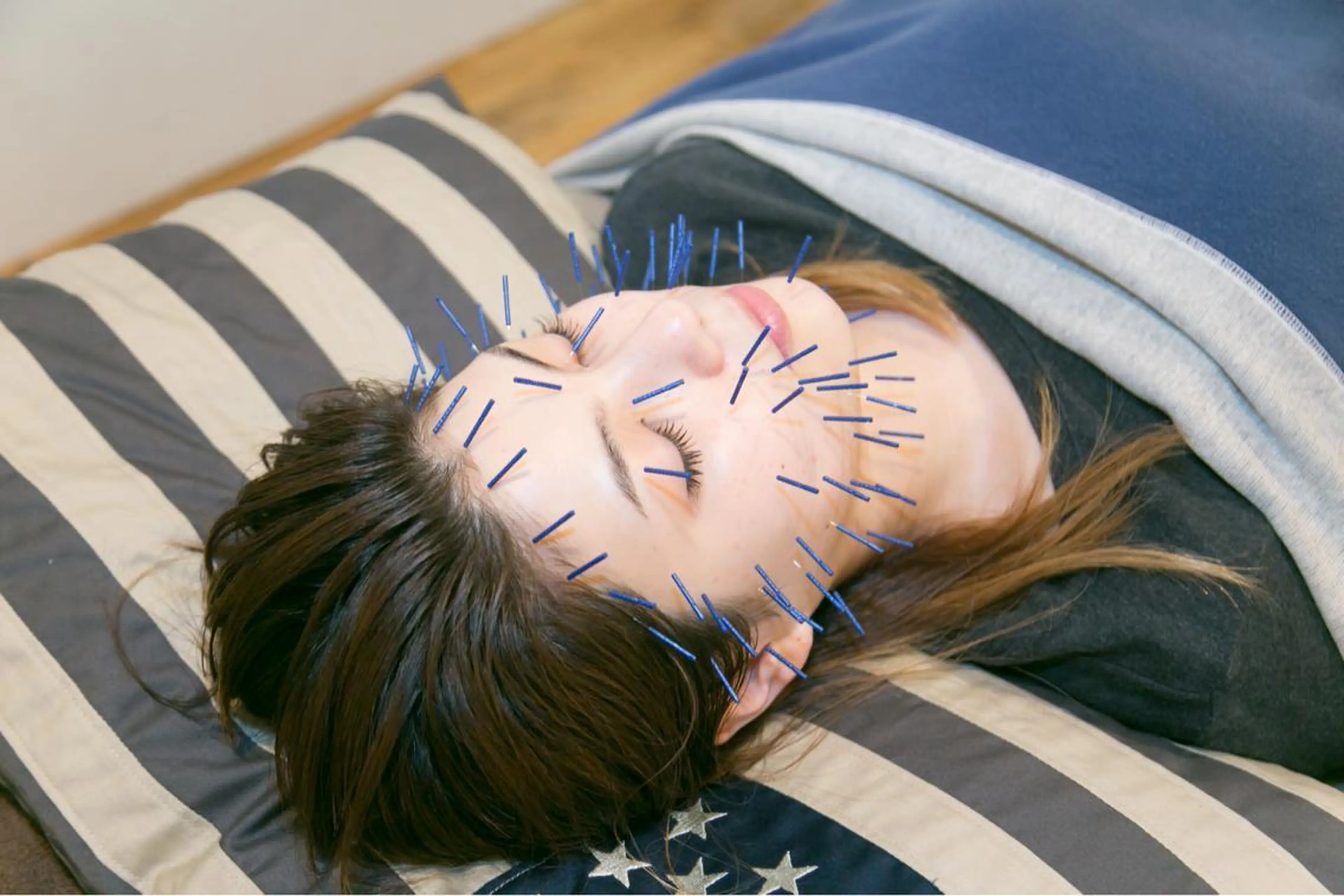 目黒/小顔/骨盤/ 美容鍼/美顔鍼/小林のエステ・リラクイメージ