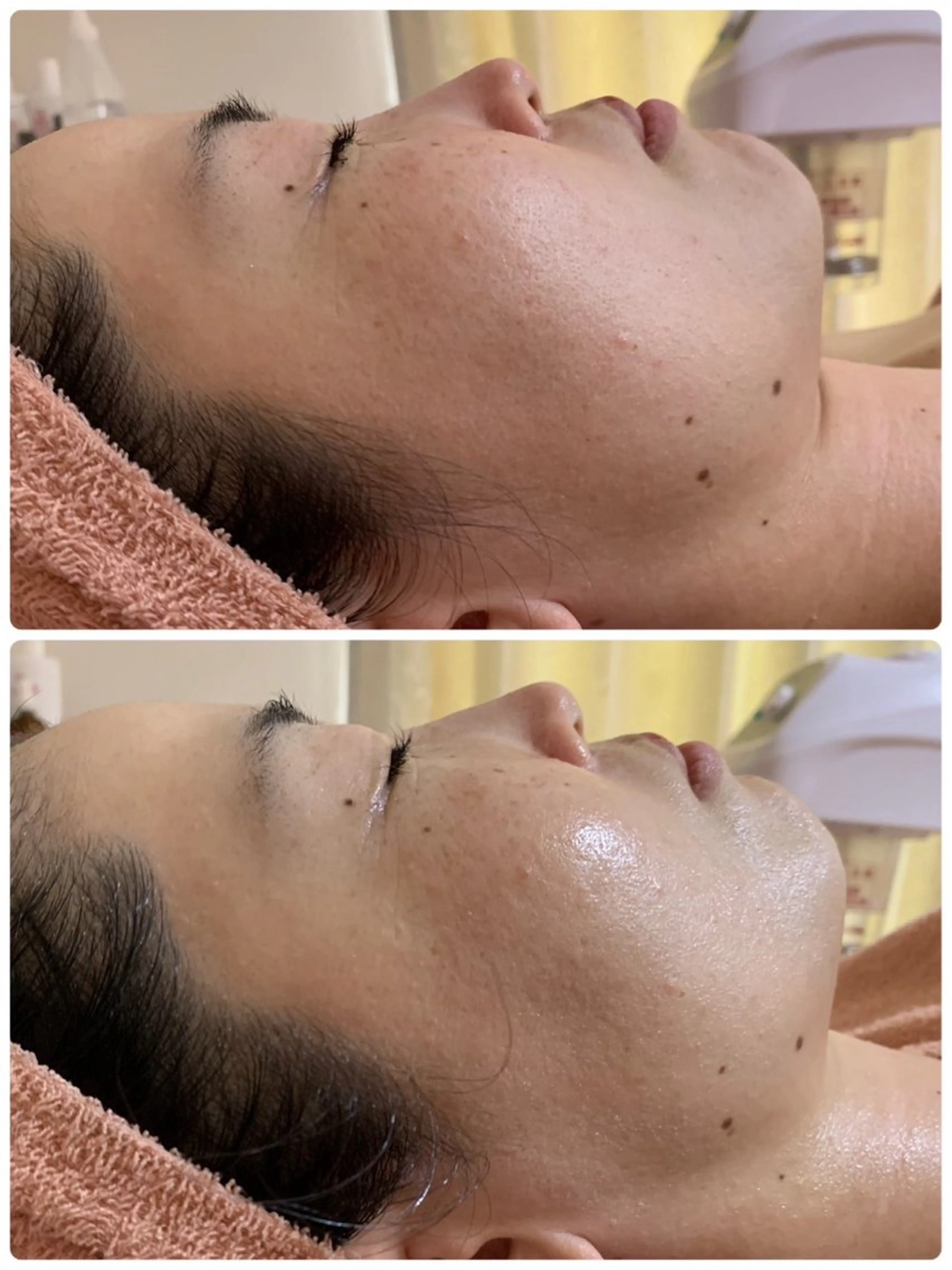 エステ 肌質改善専門店/絹々(きぬ)所属・心満たされる ハーブピーリング絹々のエステ・リラクイメージ