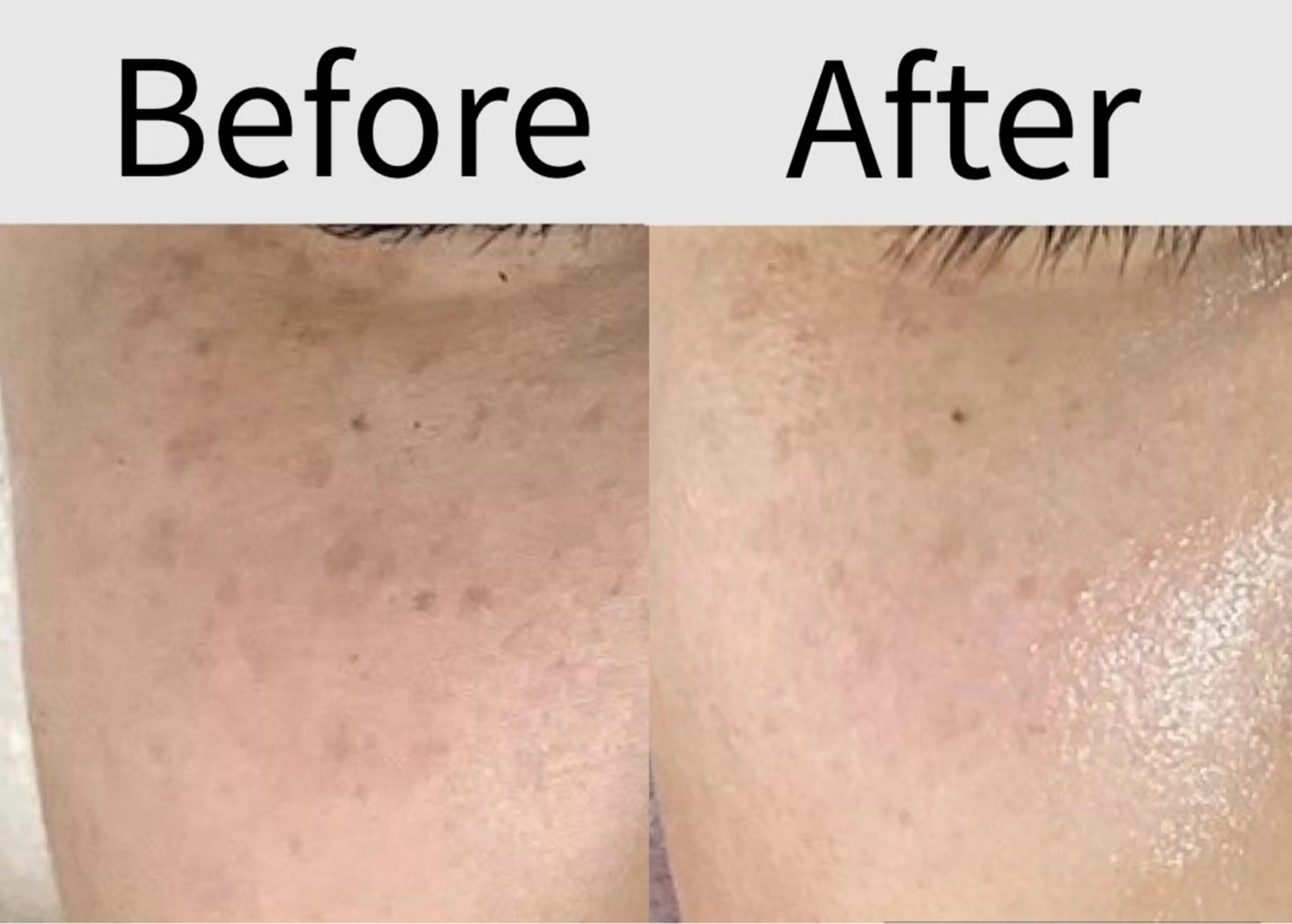 エステ 都度払い 肌質改善専門サロンのエステ・リラクイメージ