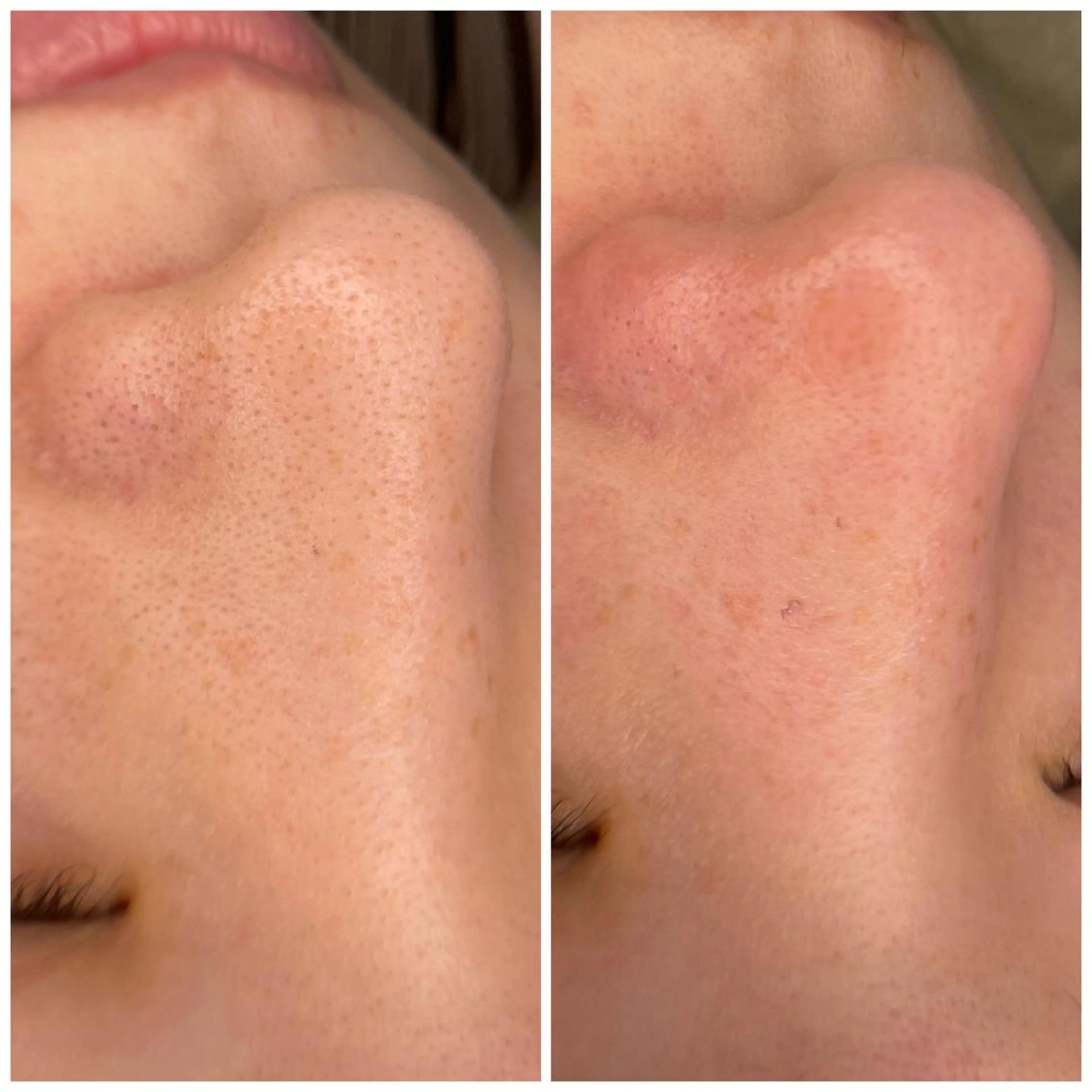 E LINDAのネイルデザイン