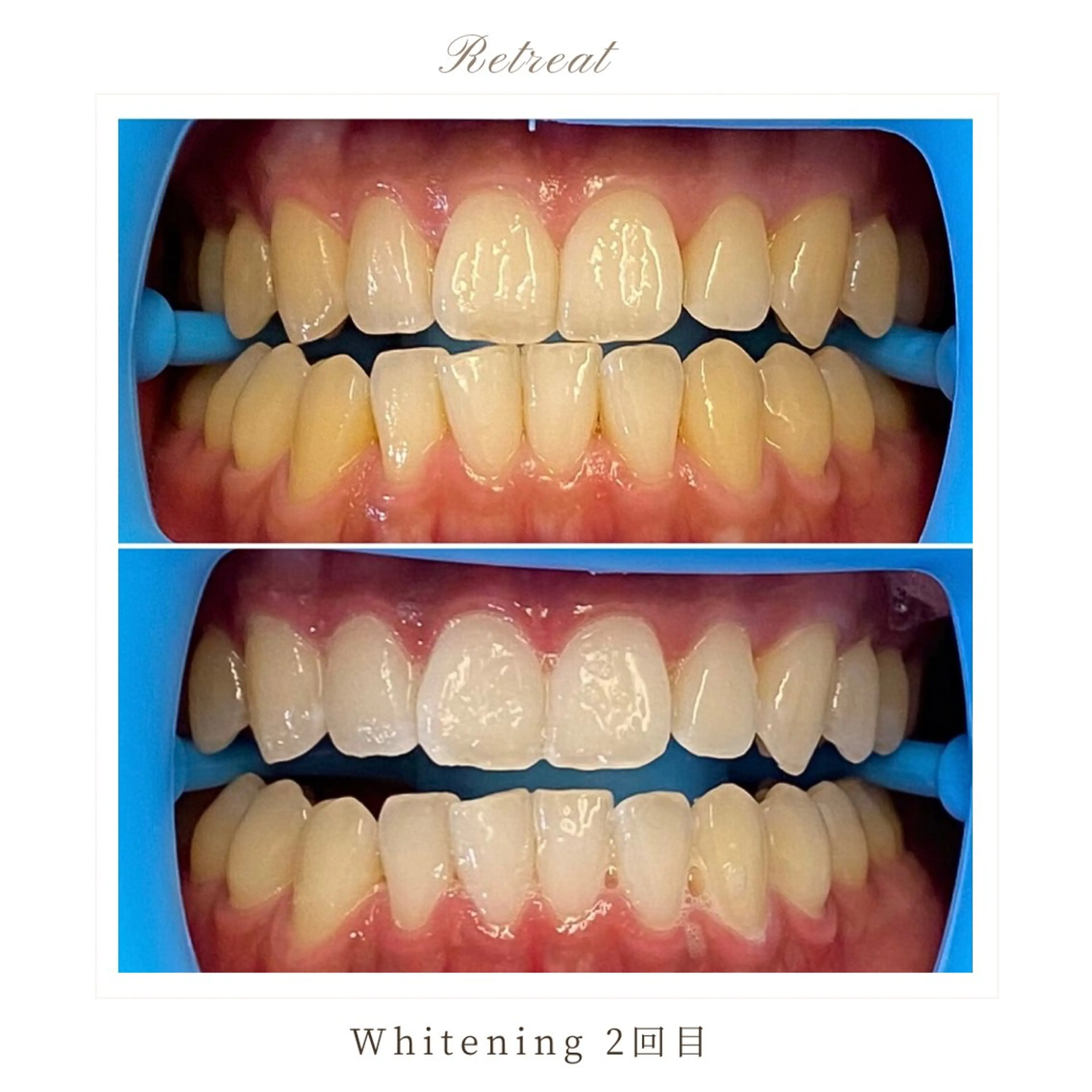 Retreatリトリート所属・歯科医院提携 Retreatのエステ・リラクイメージ